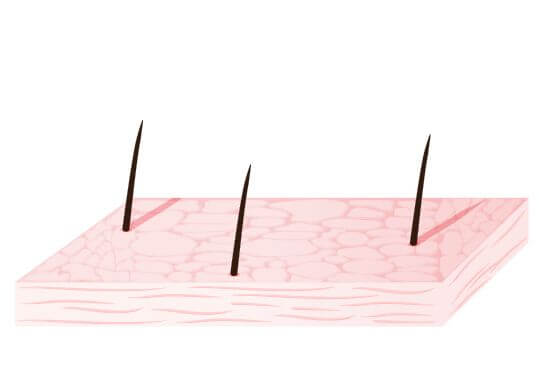 Transformez les coudes secs en une peau douce comme celle d'un bébé