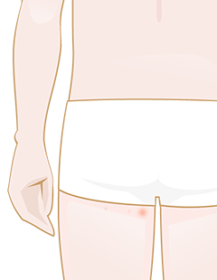boutons sur les fesses