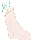 pieds malodorants