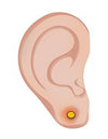 Comment surmonter l'infection d'un piercing à l'oreille