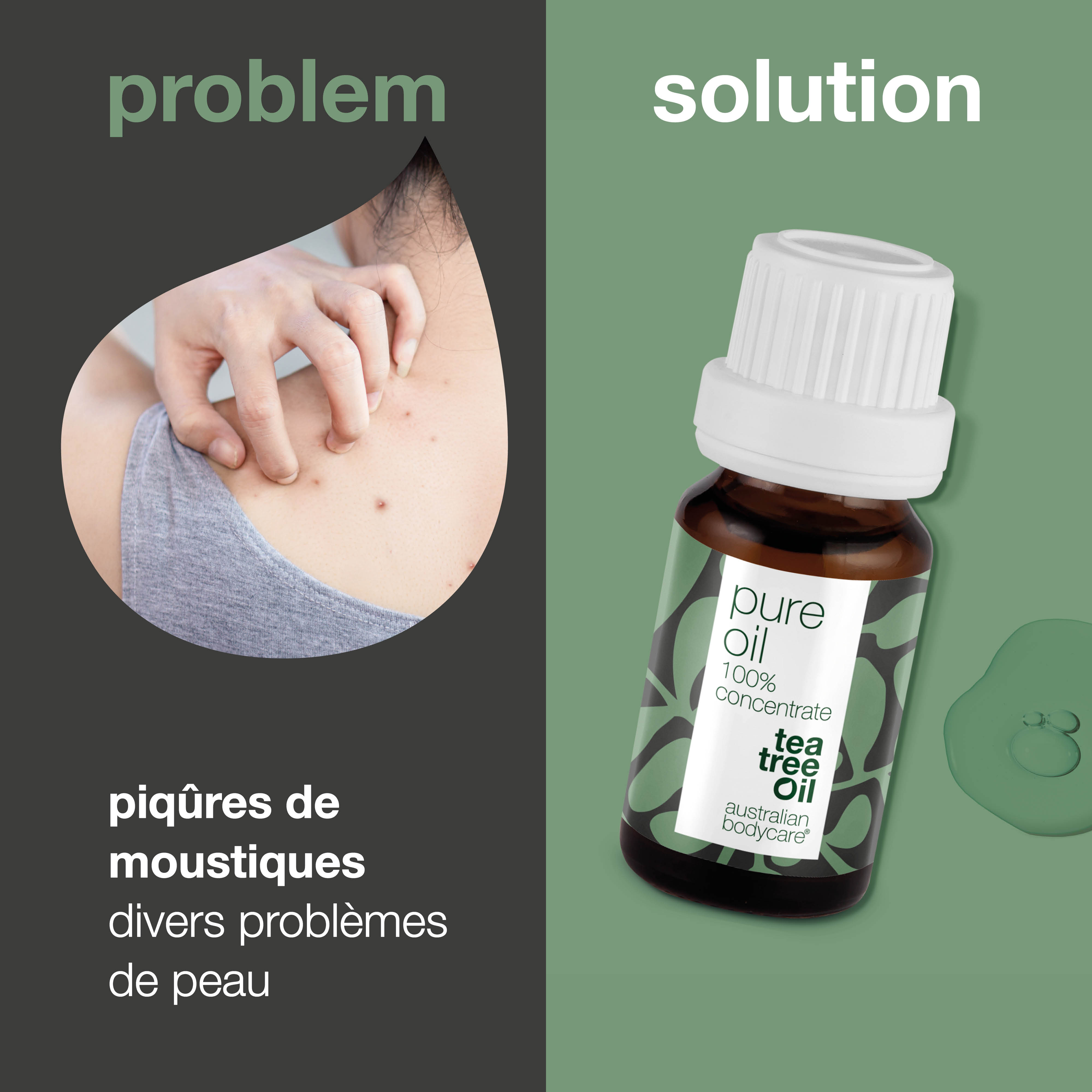 Huile de tea tree concentrée pour les problèmes de peau — Huile essentielle de Tea tree 100% naturelle et non diluée provenant d'Australie