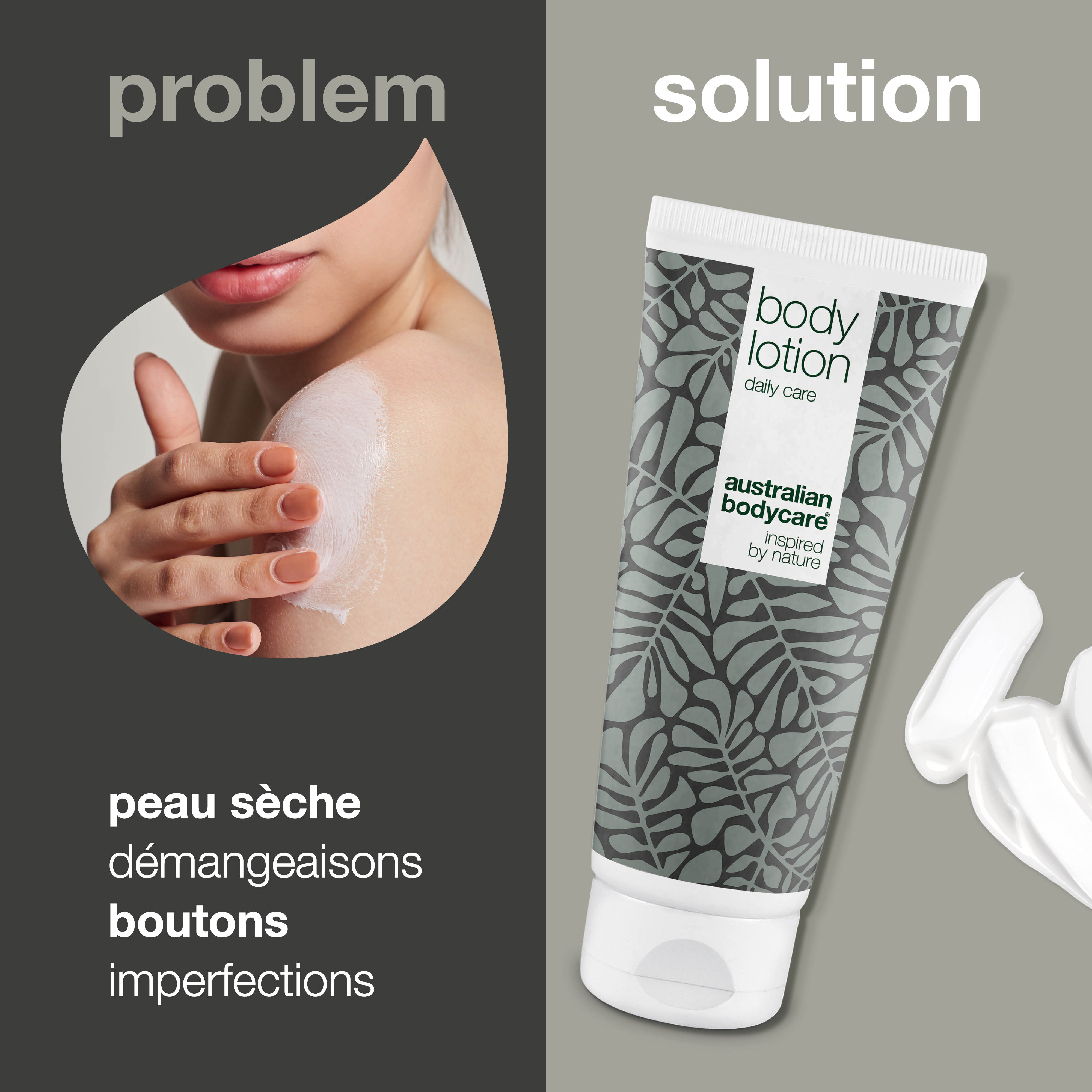 Lotion corporelle à l'arbre à thé contre la peau sèche et les taches — Crème hydratante pour la peau congestionnée et squameuse du corps