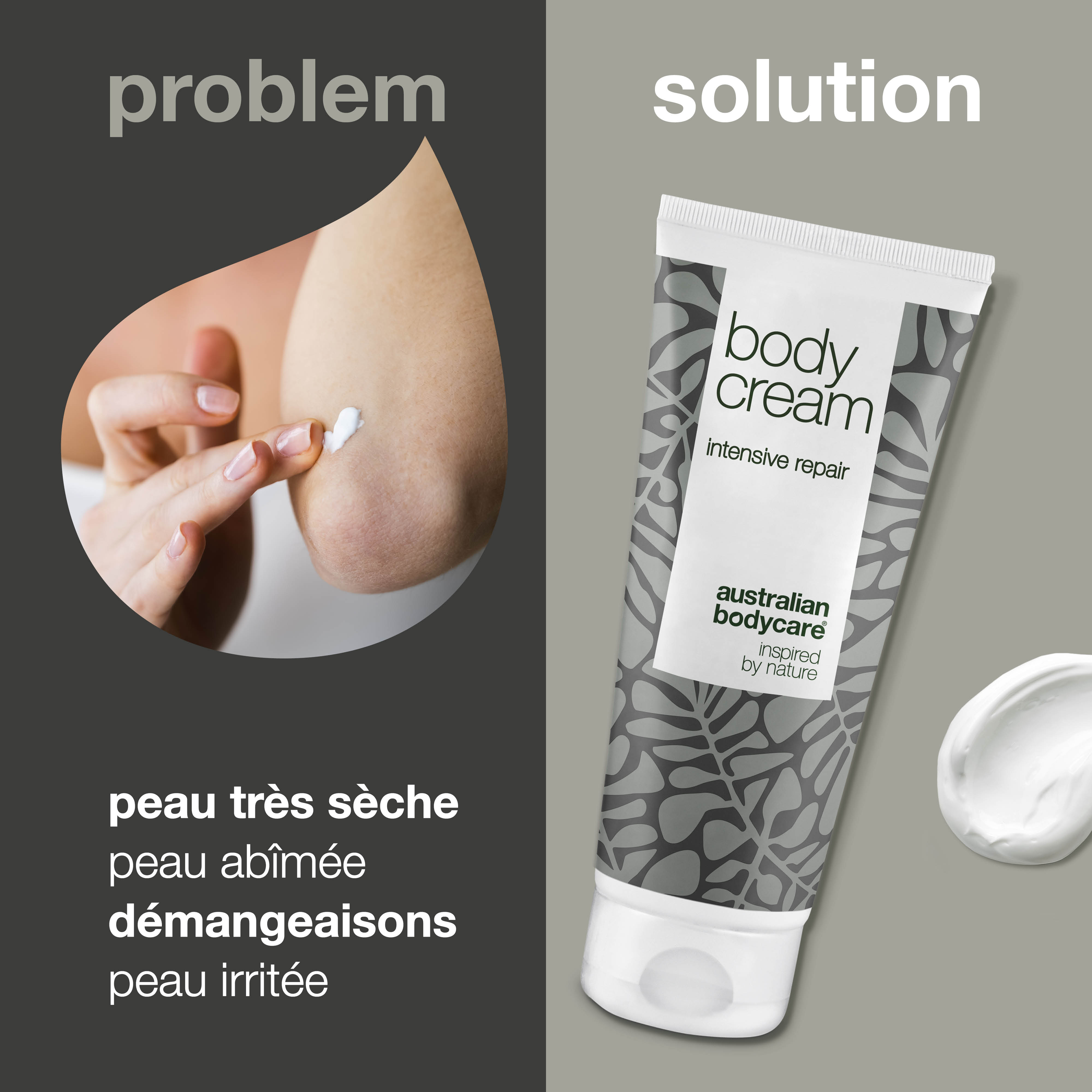 Crème corporelle pour peaux très sèches et démangeaisons — Hydratant corporel intensif pour peaux abîmées, très sèches et qui démangent