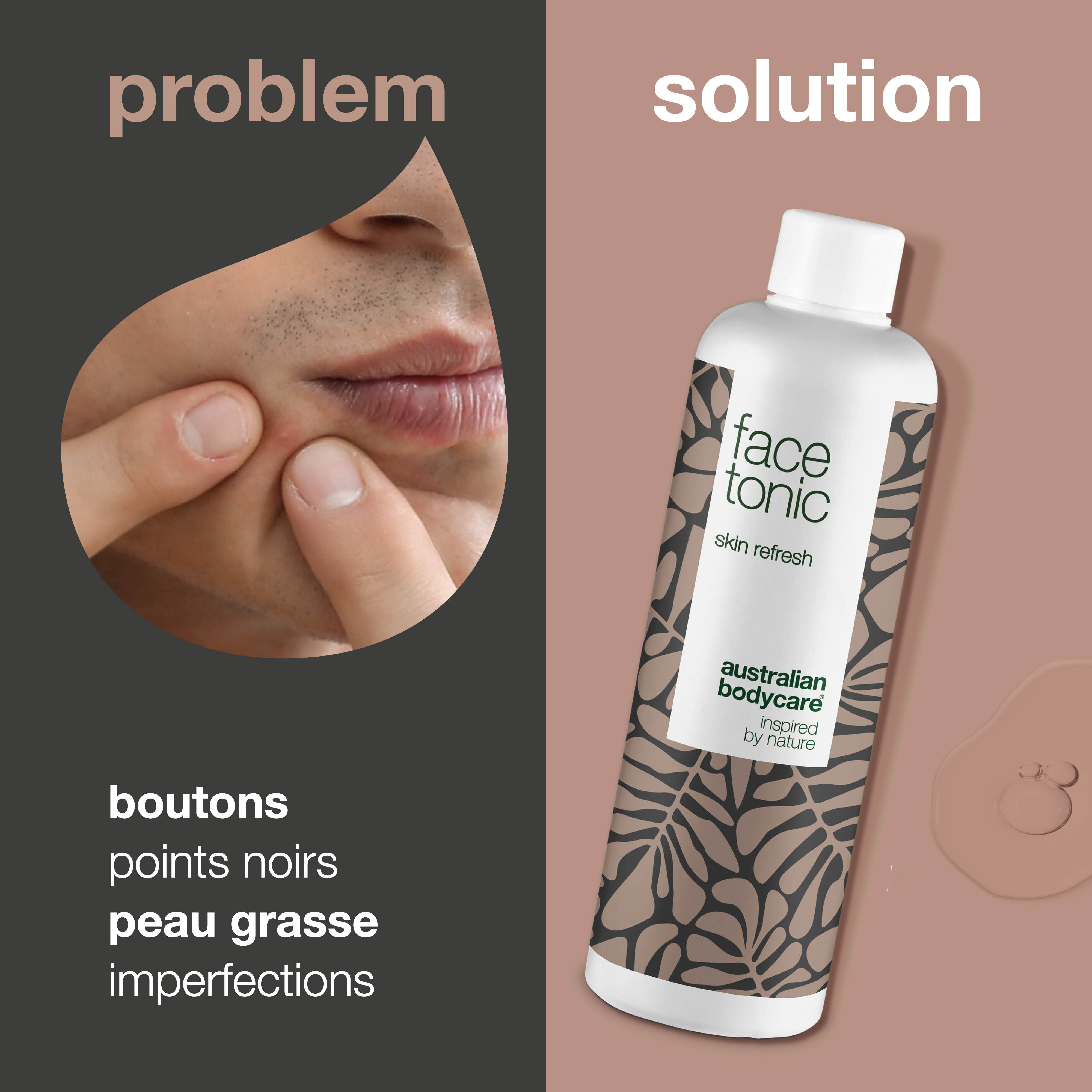 Tonique pour le visage pour un nettoyage quotidien en profondeur — Tonique pour le visage à l'huile d'arbre à thé pour les boutons, les points noirs et la peau grasse