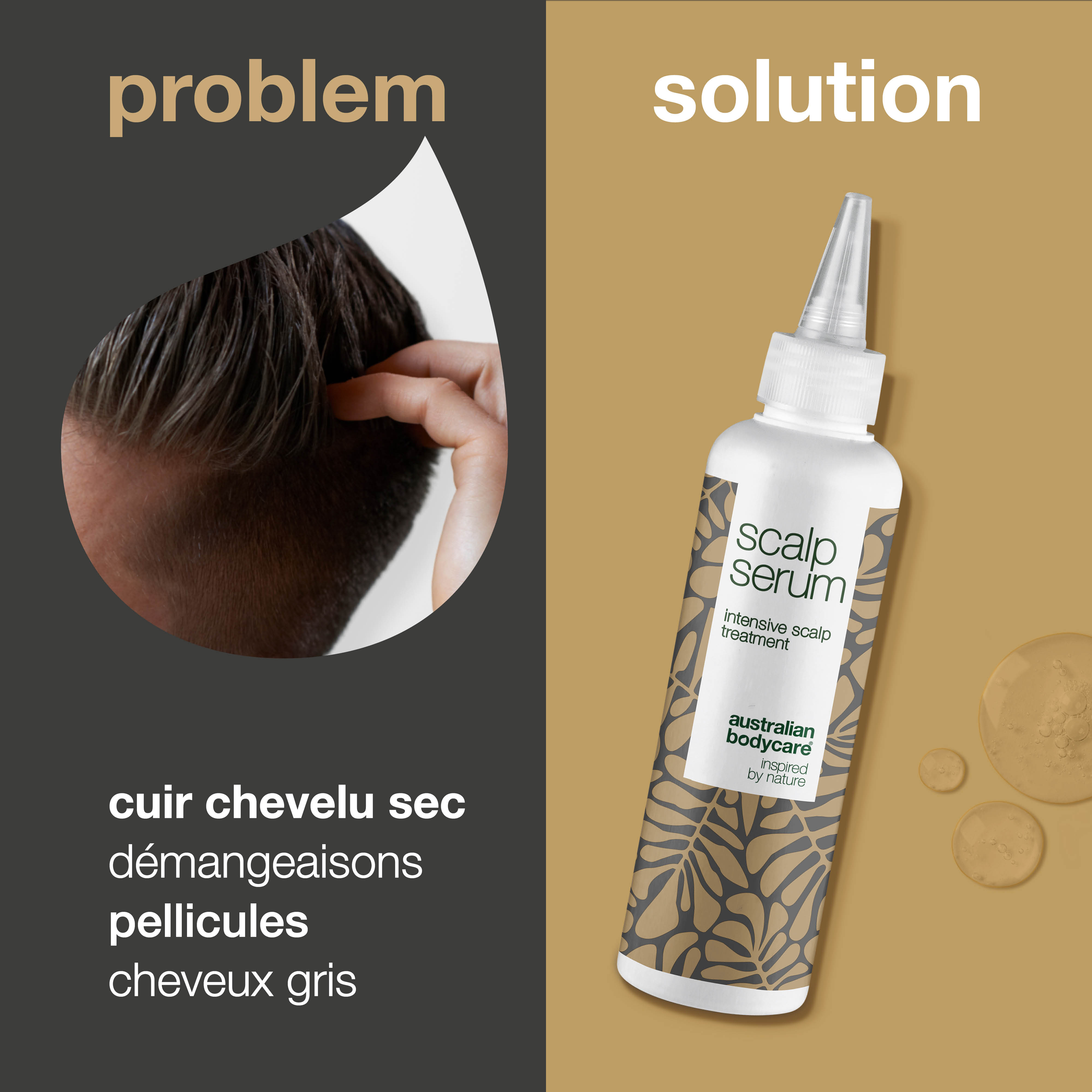 Traitement du cuir chevelu contre les pellicules et le cuir chevelu sec — Sérum pour le cuir chevelu qui démange, les cheveux gras, le cuir chevelu sec et irrité