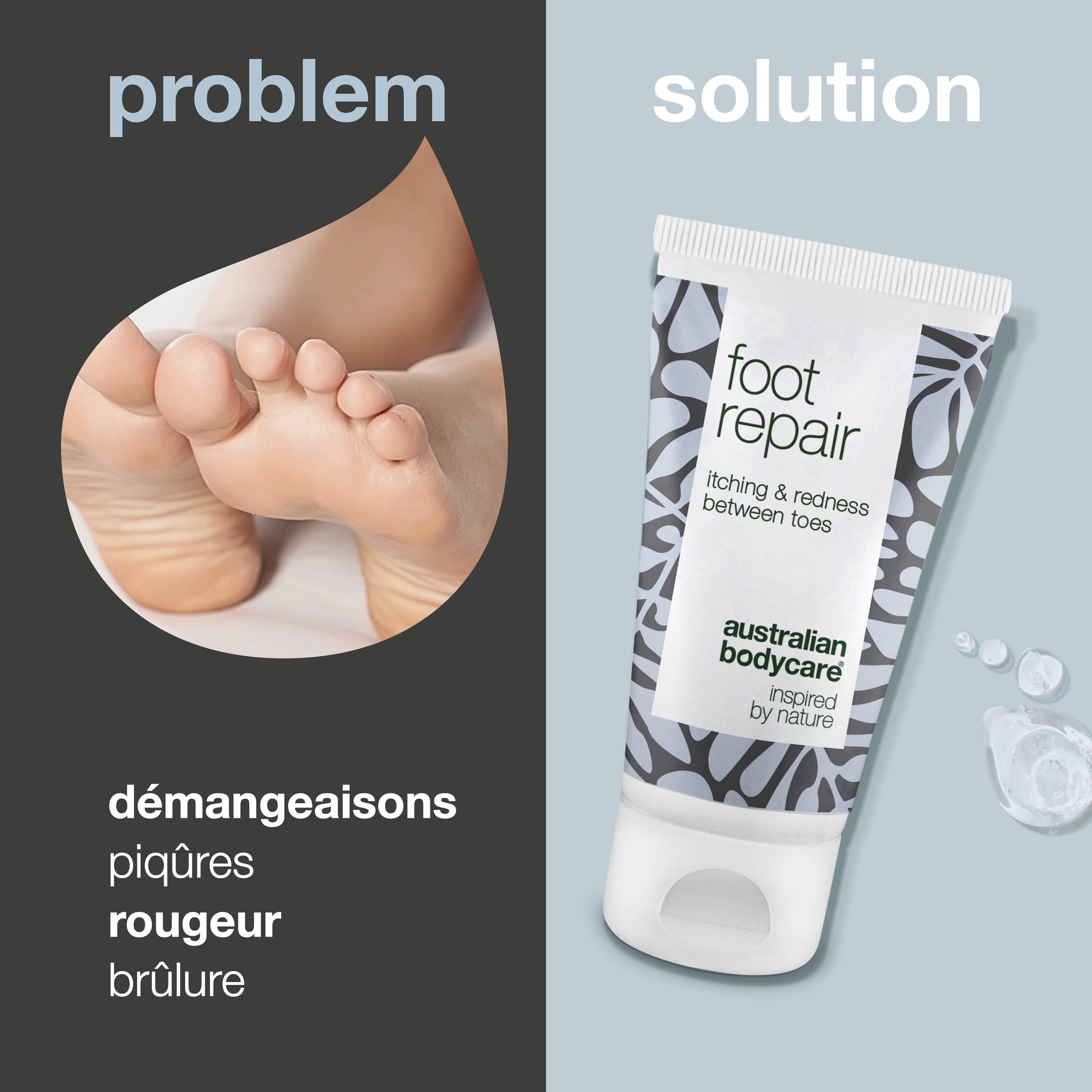 Gel pour les pieds pour les orteils rouges et qui démangent — Soulagez les démangeaisons, les picotements et les rougeurs entre vos orteils grâce à ce gel apaisant. Contient du 4-terpinéol naturel, connu à partir de l'huile d'arbre à thé. Idéal pour les soins et le soulagement quotidiens.