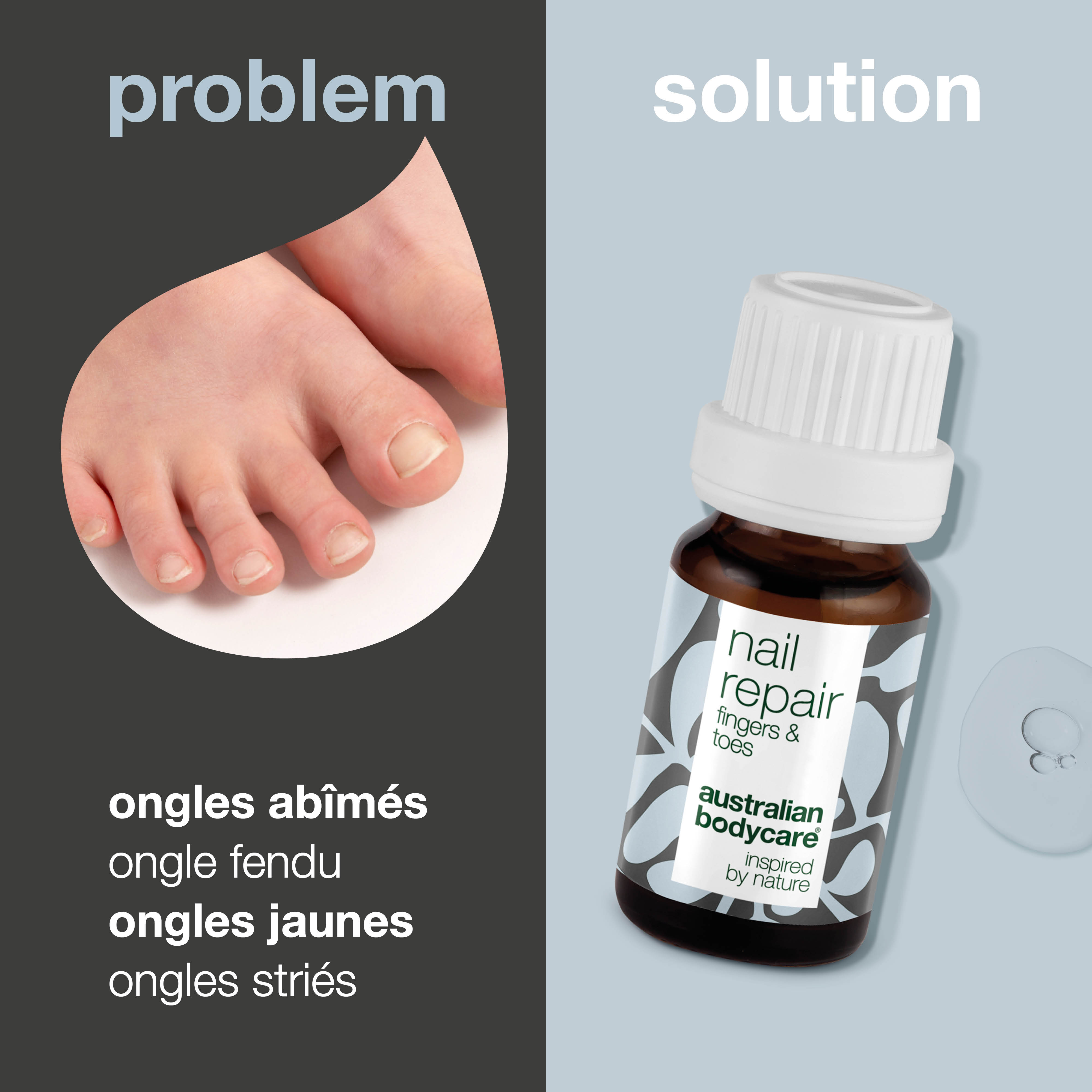 Huile à ongles pour ongles fissurés et décolorés — Restaurez la santé de vos ongles avec notre huile à ongles. Il combat les ongles craquelés, rugueux et décolorés grâce au 4-terpinéol naturel, connu à partir de l'huile d'arbre à thé, et à la vitamine E.