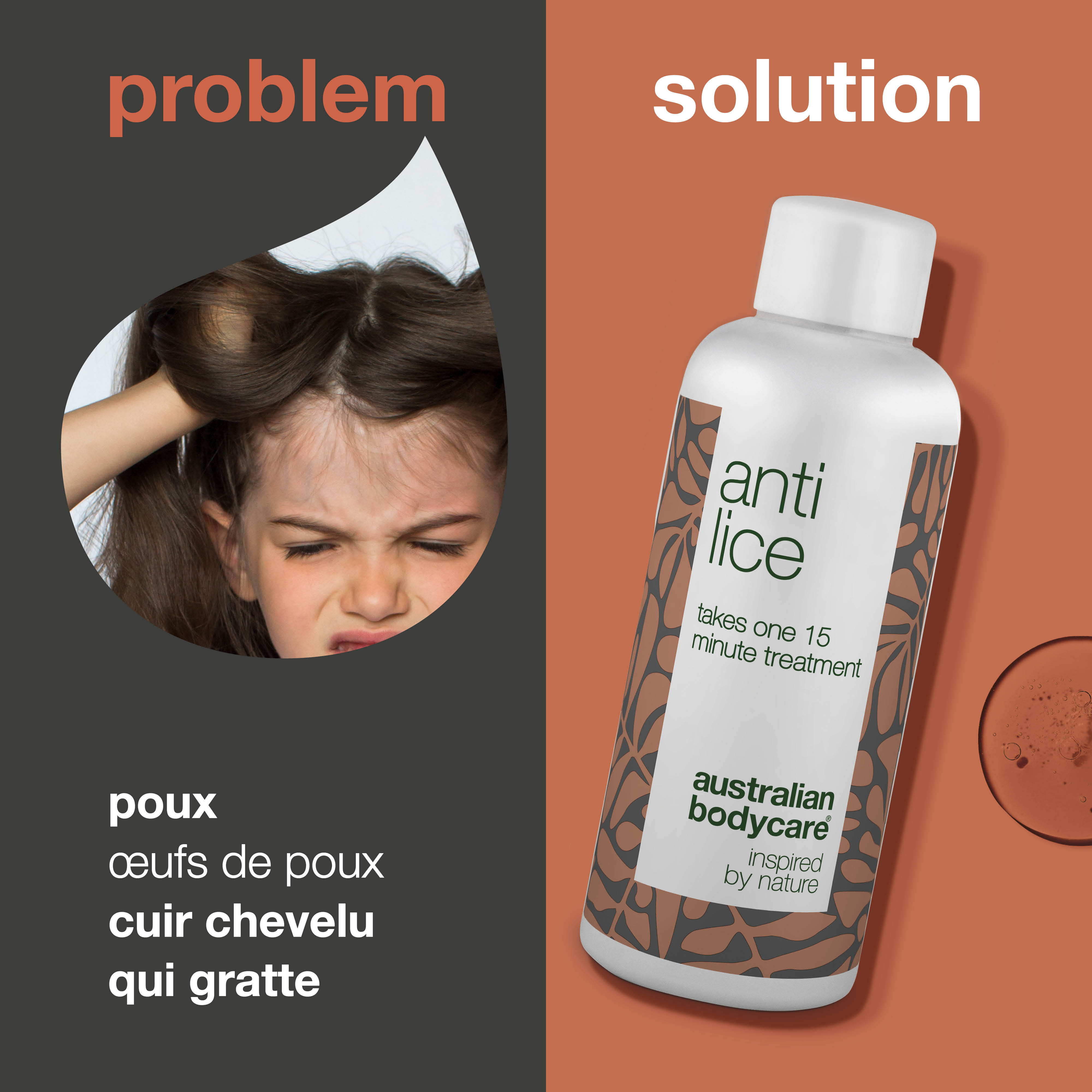 Traitement contre les poux – Traitement efficace contre les poux et les œufs en 15 minutes – Traitement contre les poux non toxique avec des ingrédients naturels. Encapsule et étouffe les poux et les œufs. Sans parabène ni insecticide.