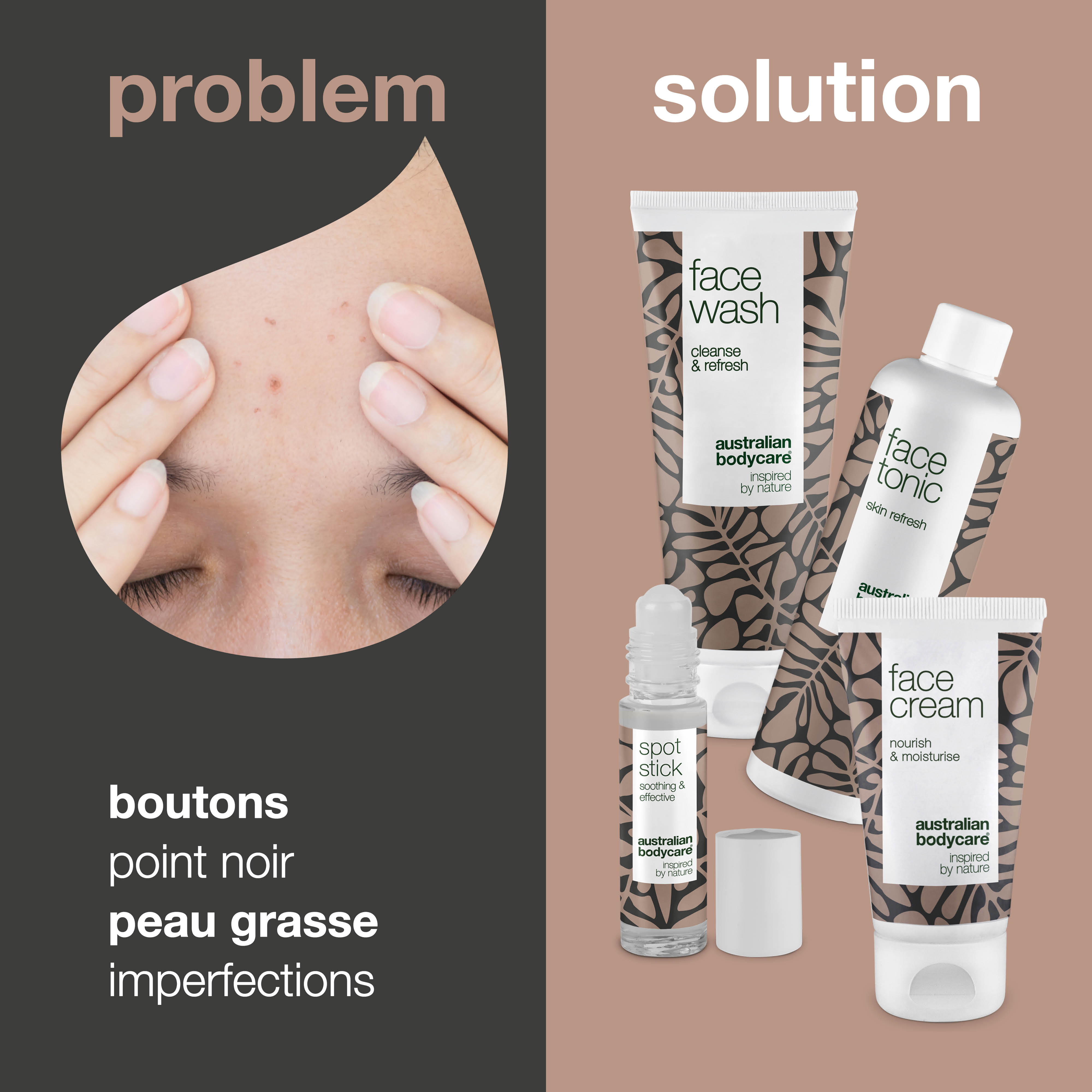 Kit de soins du visage pour les imperfections cutanées — 4 des meilleurs produits contre les points noirs, pour se débarrasser des taches sur le visage et pour le soin quotidien de l'acné
