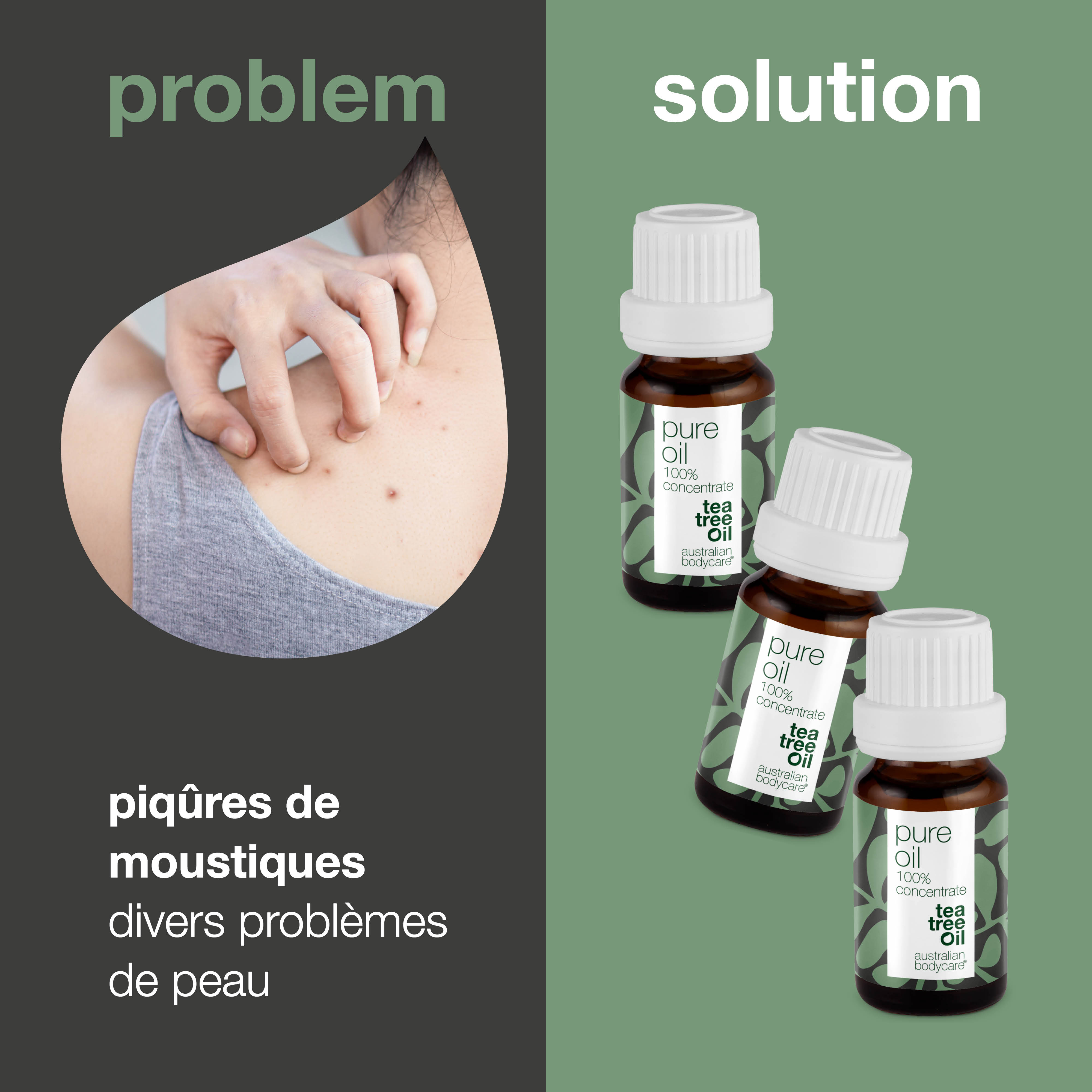 3 x XL 30 ml d'huile d'arbre à thé pour les problèmes de peau — 3 paquets d'huile d'arbre à thé 100 % concentrée et non diluée d'Australie
