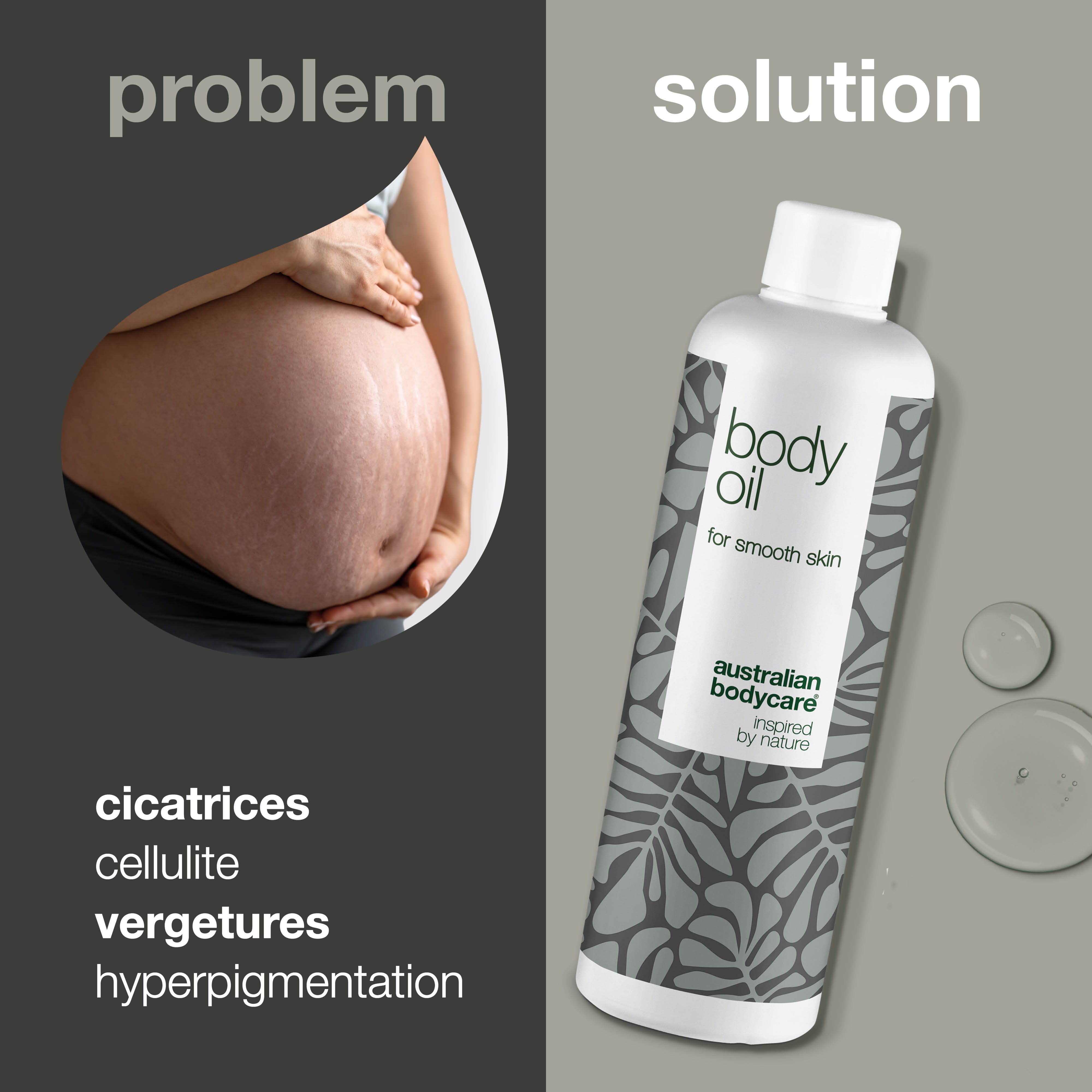 Body Oil – Réduit vergetures, cicatrices et taches pigmentaires — Body Oil réduit vergetures, cicatrices et taches. Avec huile d’amande, squalane et vitamine E, il hydrate et adoucit la peau.
