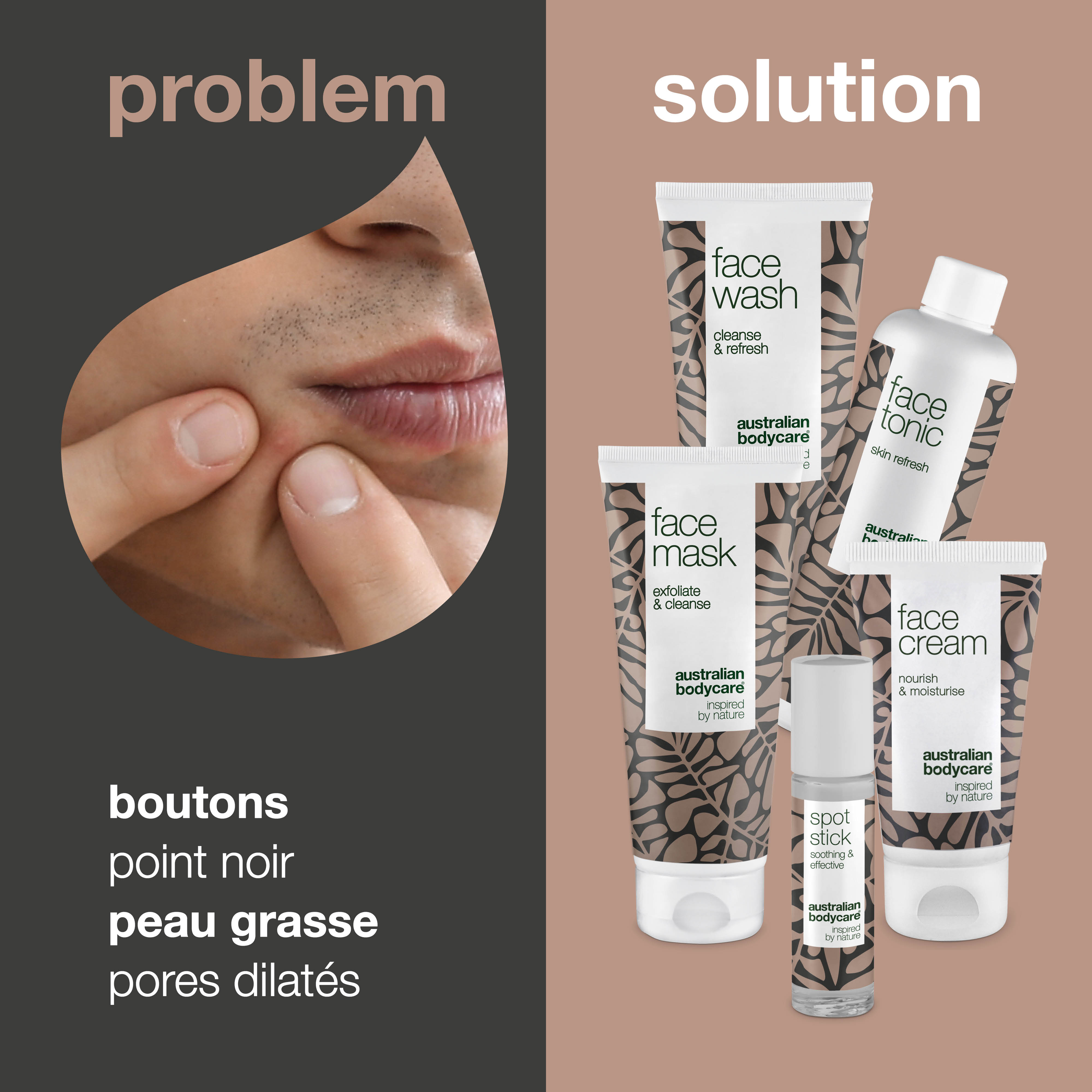 Le masque visage ultime pour les peaux à imperfections — 5 produits nettoyants pour les peaux grasses avec boutons et points noirs