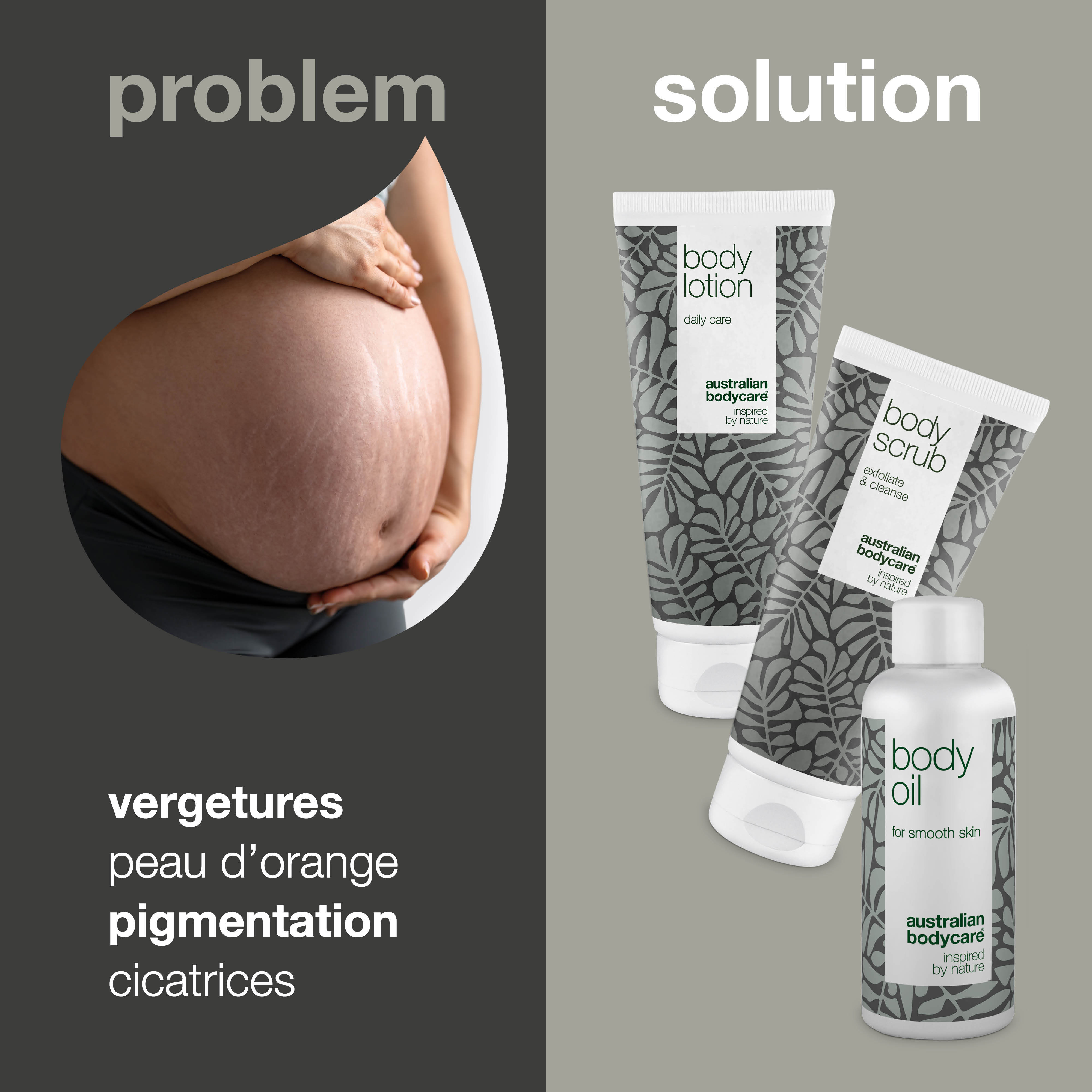 Pack de 3 pour réduire les vergetures — 3 produits pour réduire la visibilité des vergetures et des cicatrices