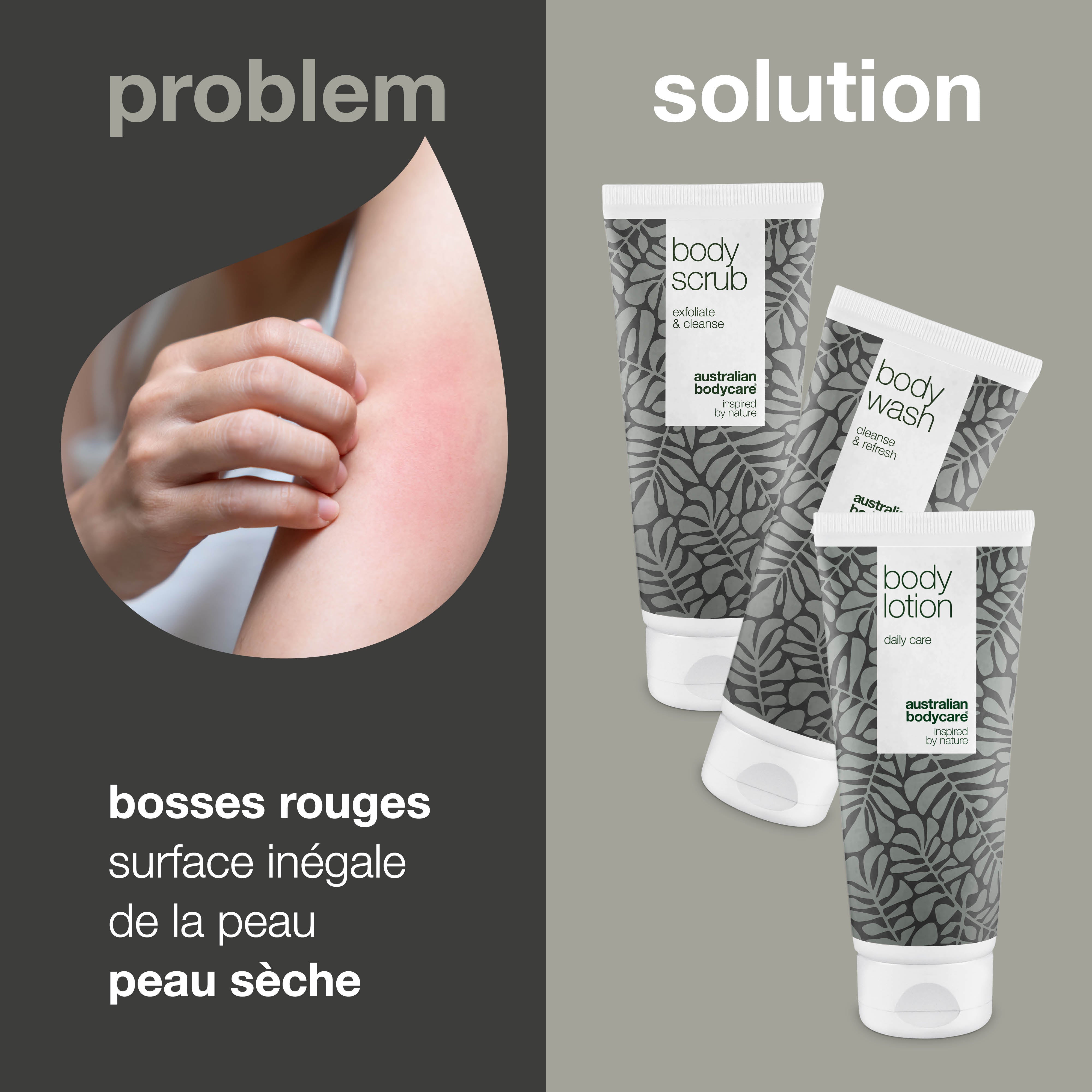 Pack de 3 pour soigner la kératose pilaire — Minimise les petites bosses sur la peau et les taches rouges causées par la kératose pilaire