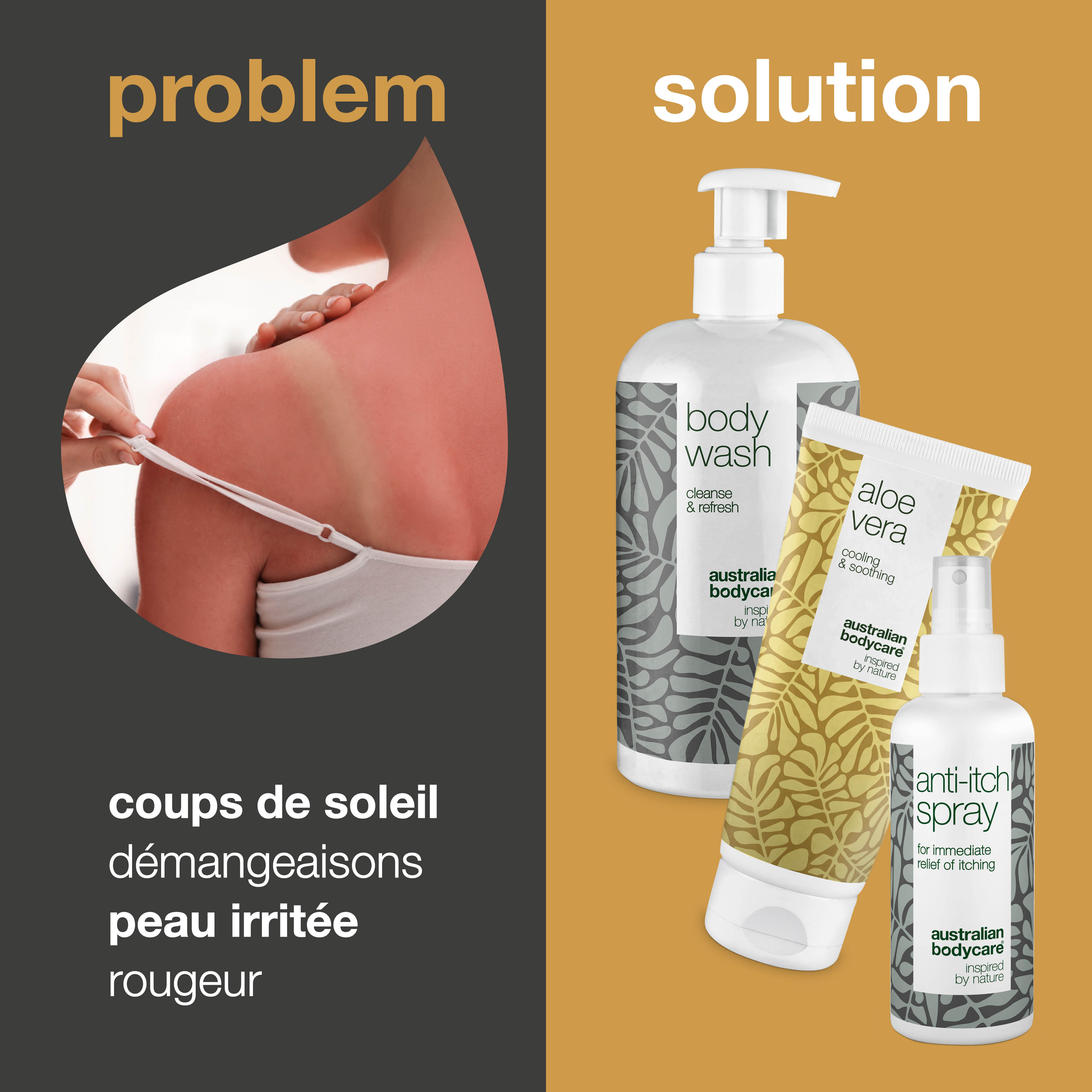 Coffret après-soleil pour peaux rouges et abîmées par le soleil — 3 produits pour soigner les coups de soleil, les sensations de brûlure et les éruptions cutanées