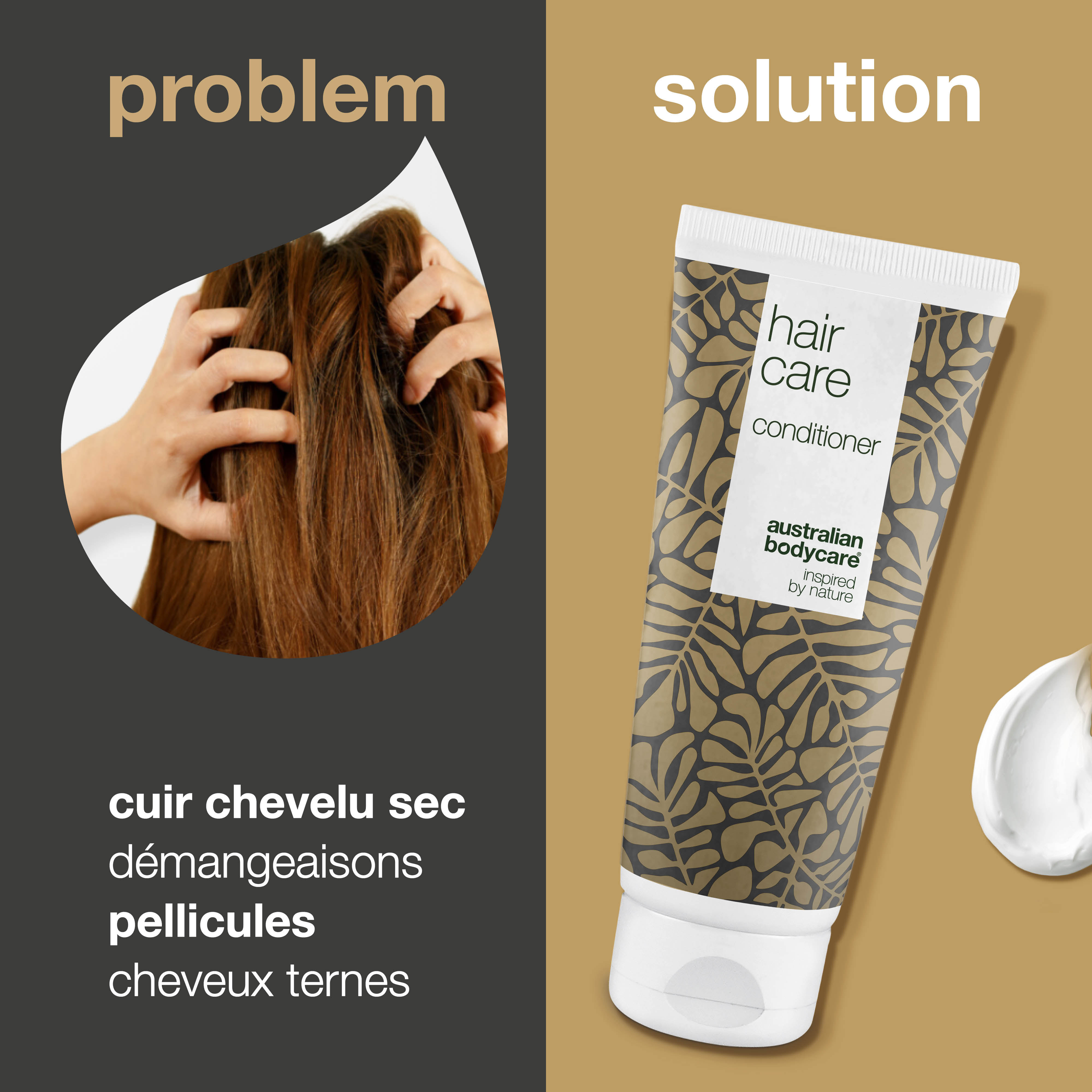 Après-shampoing pour cuir chevelu sec, démangeaisons et pellicules — Après-shampooing nourrissant pour hydrater le cuir chevelu irrité et prendre soin des cheveux