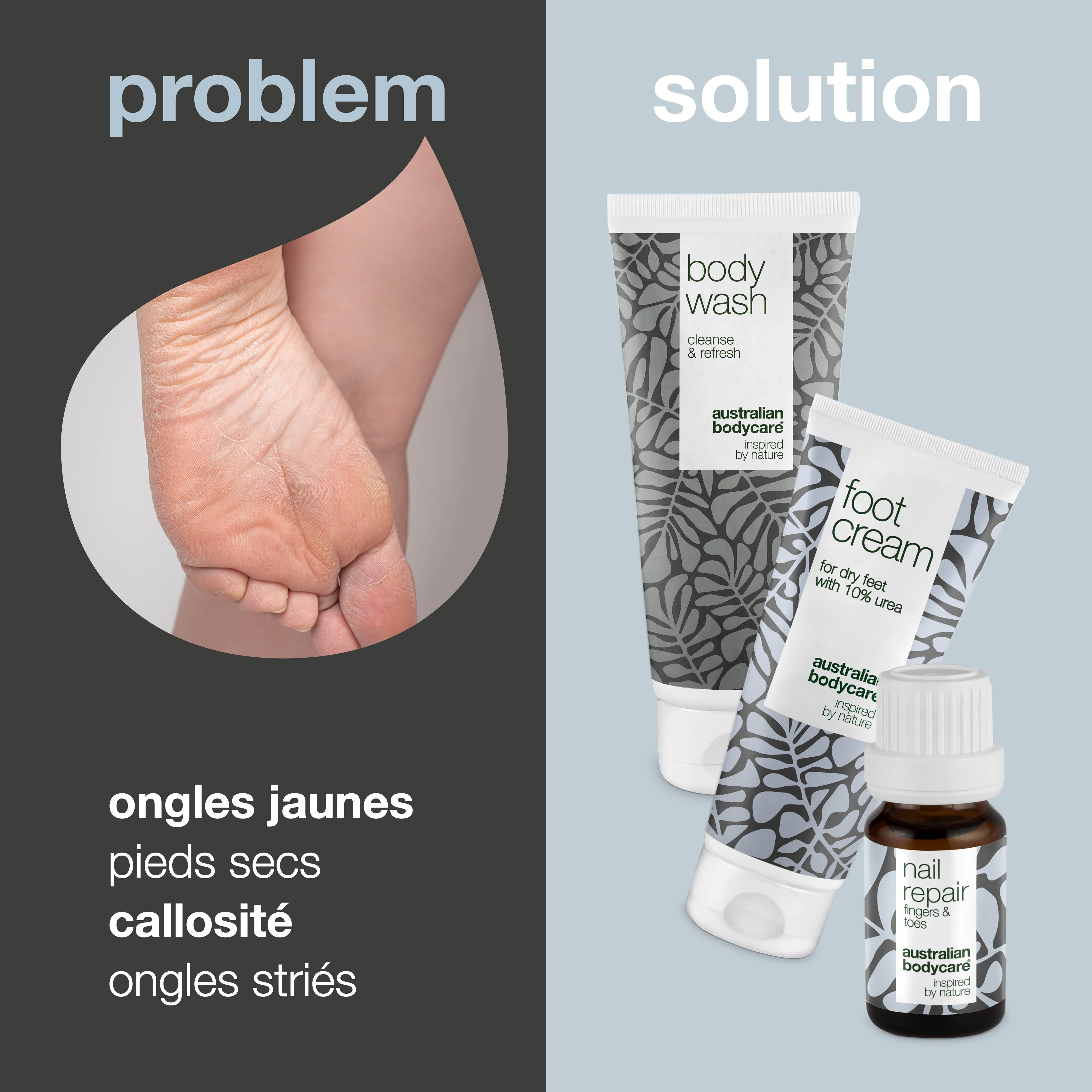 Kit de soins des pieds — 3 produits pour le soin quotidien des pieds secs et des ongles jaunes