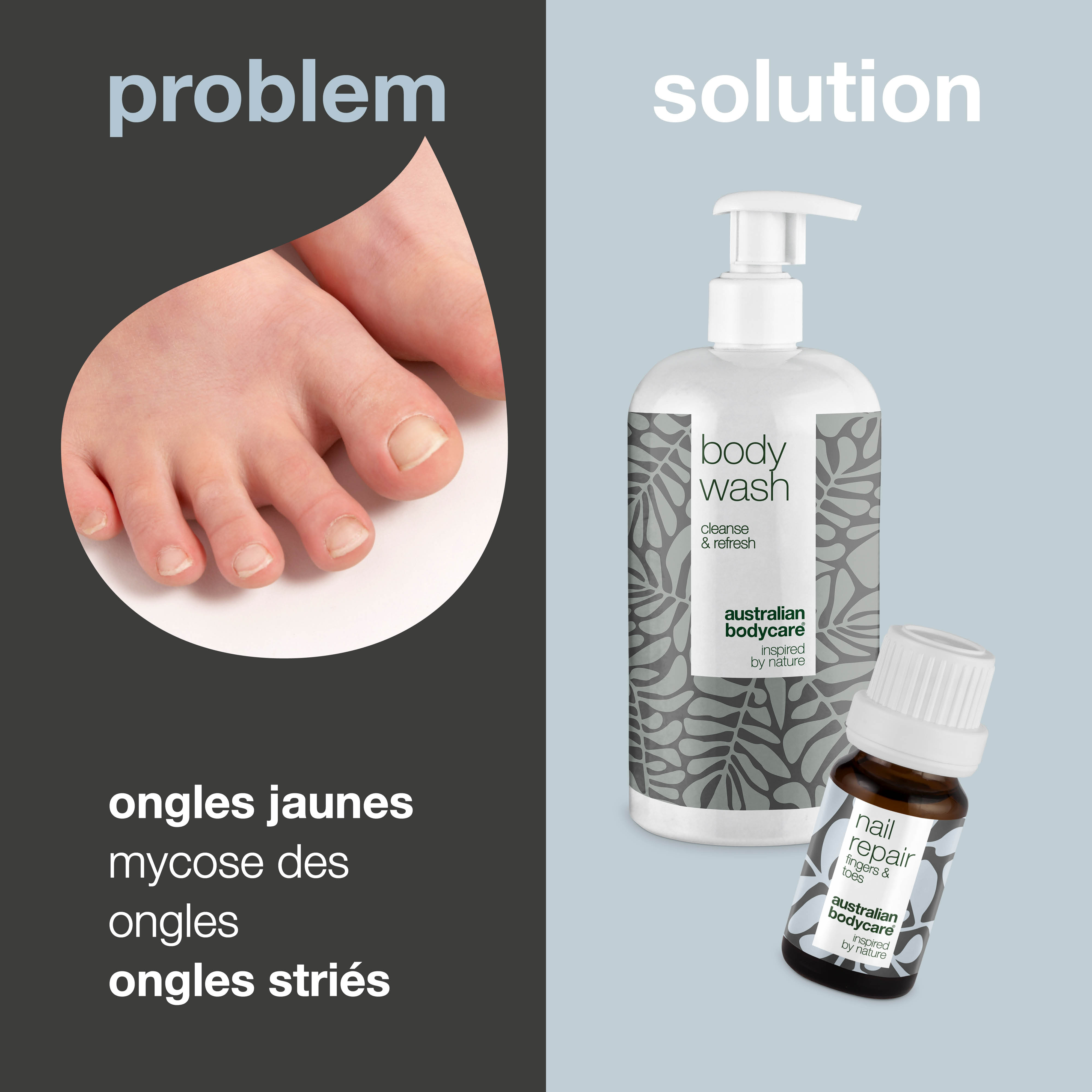 Soins des ongles pour les ongles jaunes et les mycoses des ongles — 2 produits pour les ongles jaunes et les mycoses des ongles