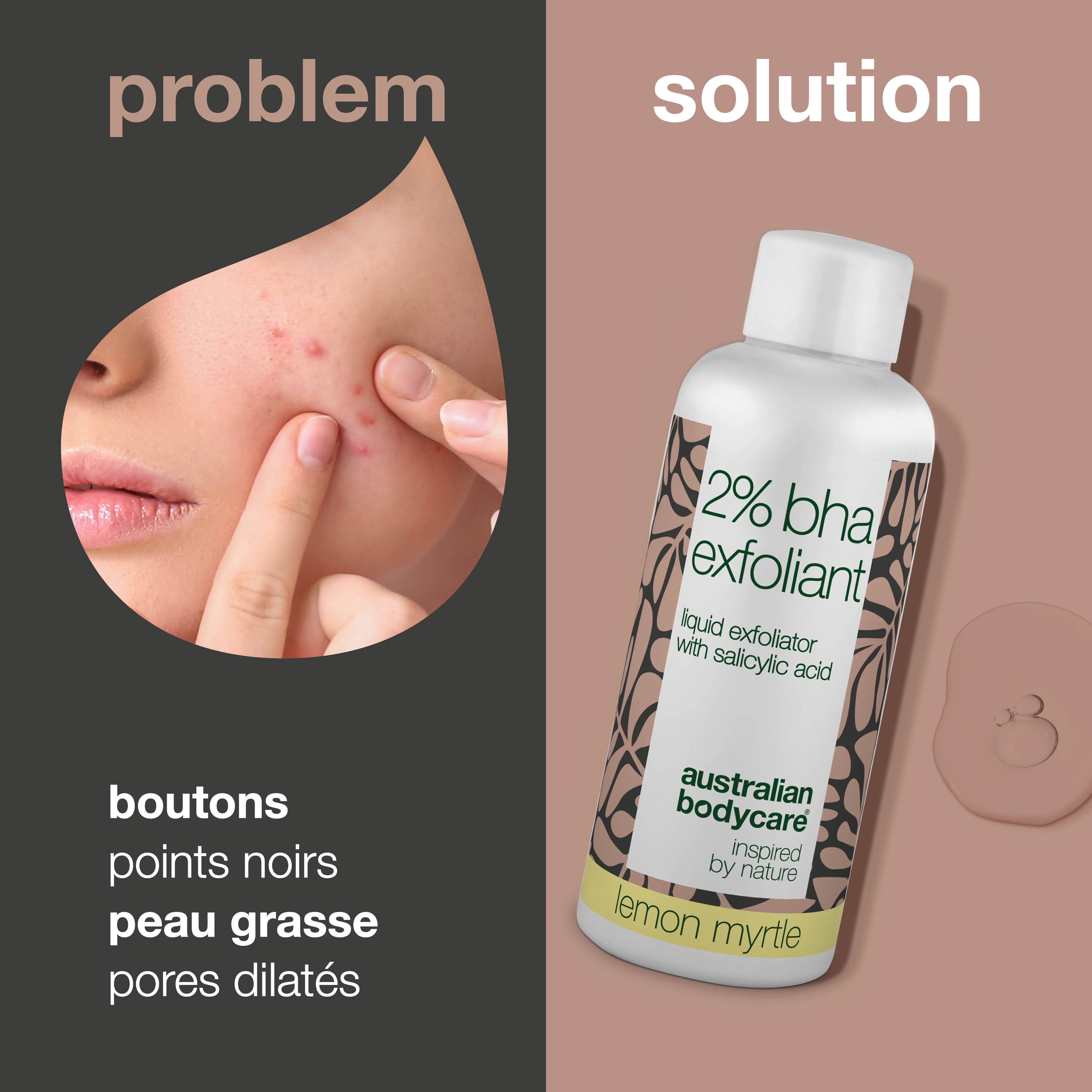 Exfoliant à l'acide salicylique 2 % BHA pour peaux grasses et impures — Obtenez une peau claire et lisse avec notre exfoliant naturel. Réduit les points noirs, les boutons et les pores dilatés.