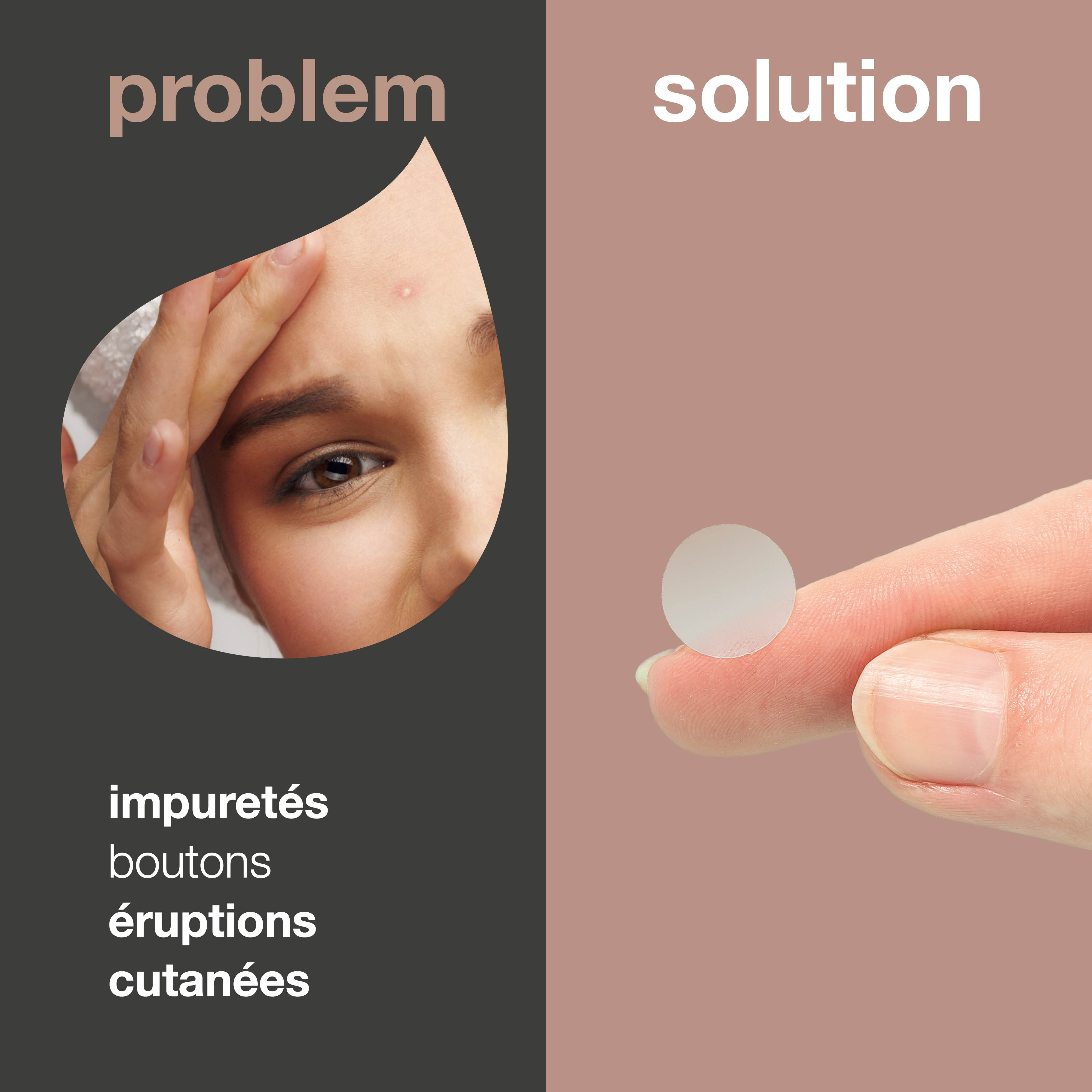 Patchs anti-boutons pour boutons — Patchs efficaces contre l'acné avec de l'acide hyaluronique et de l'acide salicylique