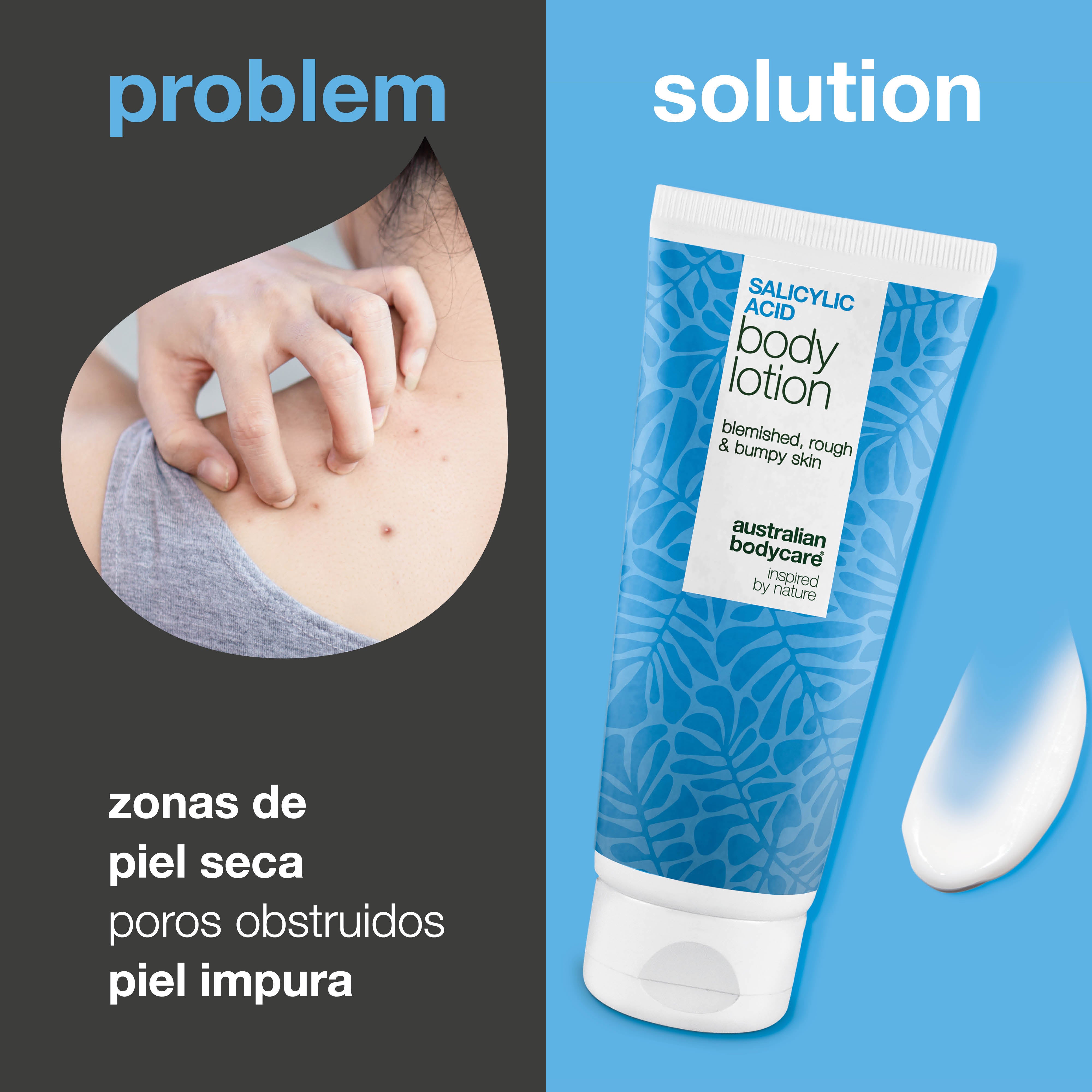 Lotion corps à l’acide salicylique – peau sèche et irrégulière — Lotion à l’acide salicylique qui exfolie, hydrate et aide à lisser la peau sèche et irrégulière. Idéale pour un usage quotidien.