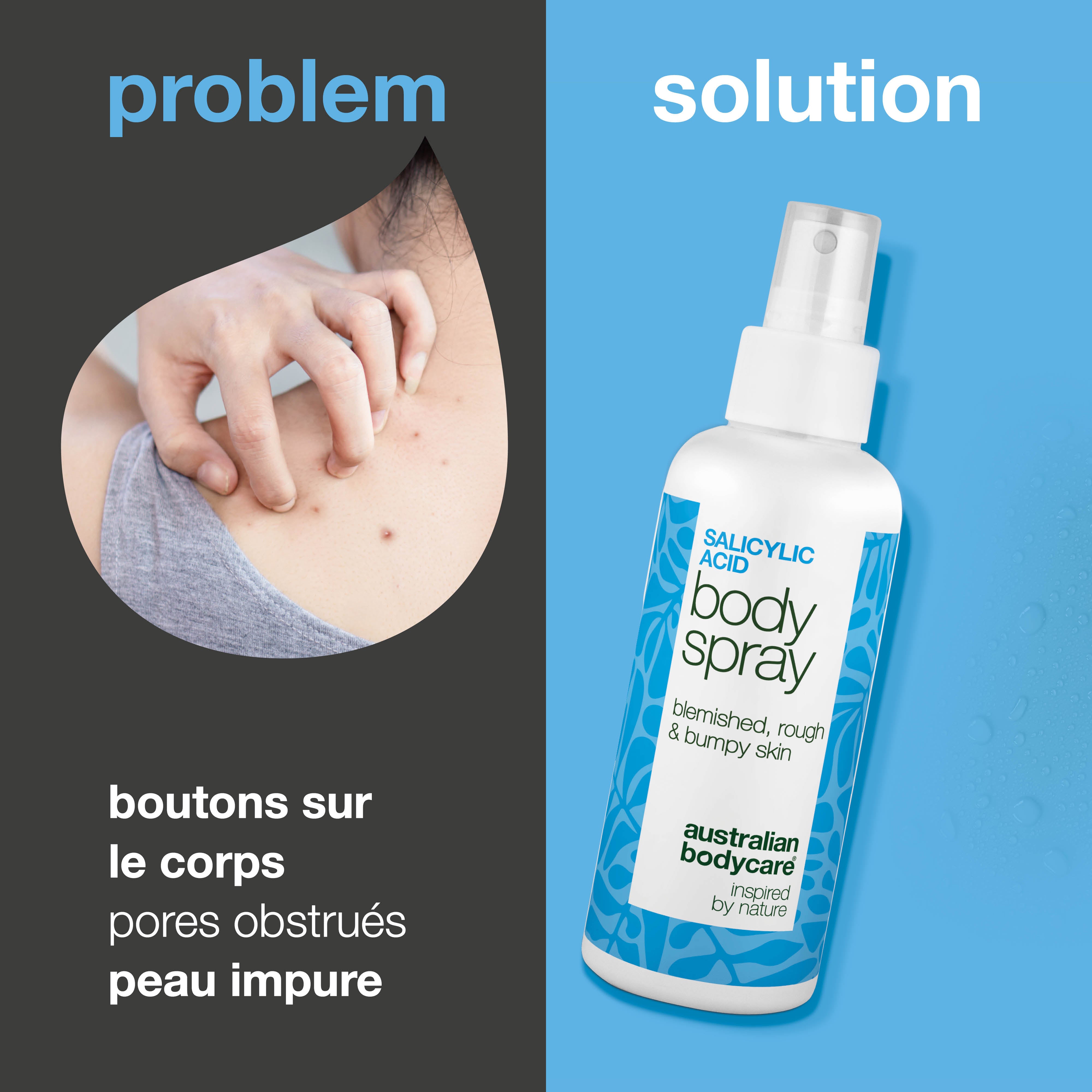 Spray à l’acide salicylique pour boutons et pores obstrués — Spray contre boutons et pores bouchés. Contient 2 % d’acide salicylique et acide glycolique pour purifier et lisser la peau.