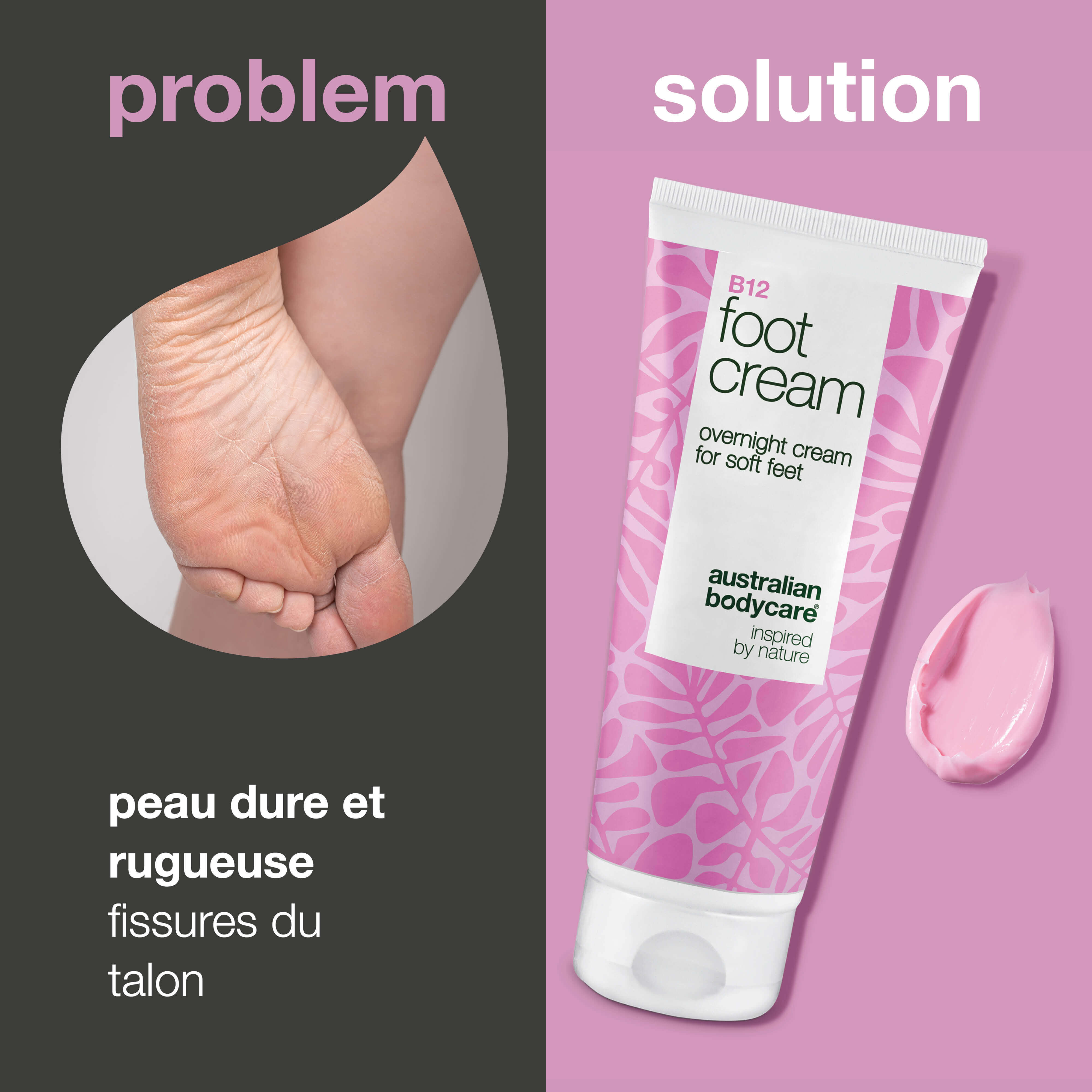 Crème pieds à la vitamine B12 – hydrate et adoucit — Crème pieds avec vitamine B12 et 10% d’urée. Hydrate et adoucit la peau. Idéale en soin de nuit ou après un bain de pieds.