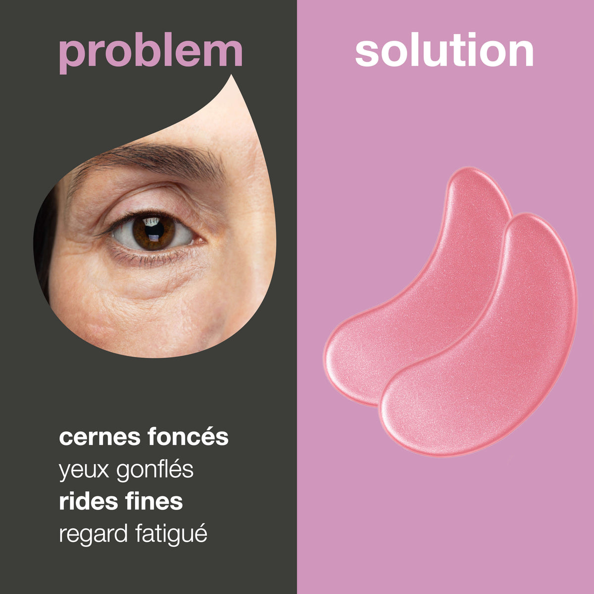 Fatigue Patch Patches de Soin Visage – Boutons, Yeux & Hydratation Ciblée