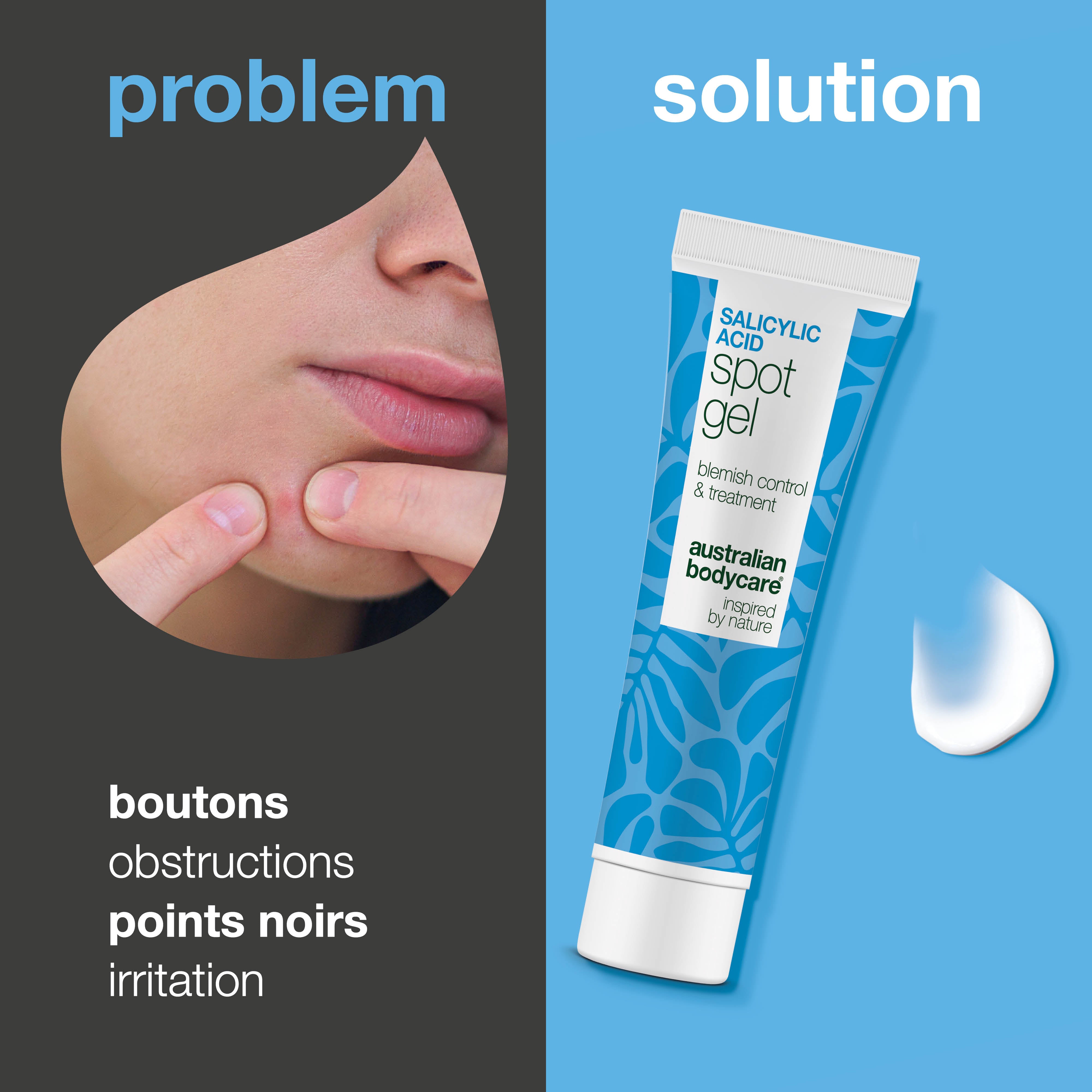 Gel Spot à l’acide salicylique – réduit boutons, points noirs et rougeurs, purifie et calme la peau
