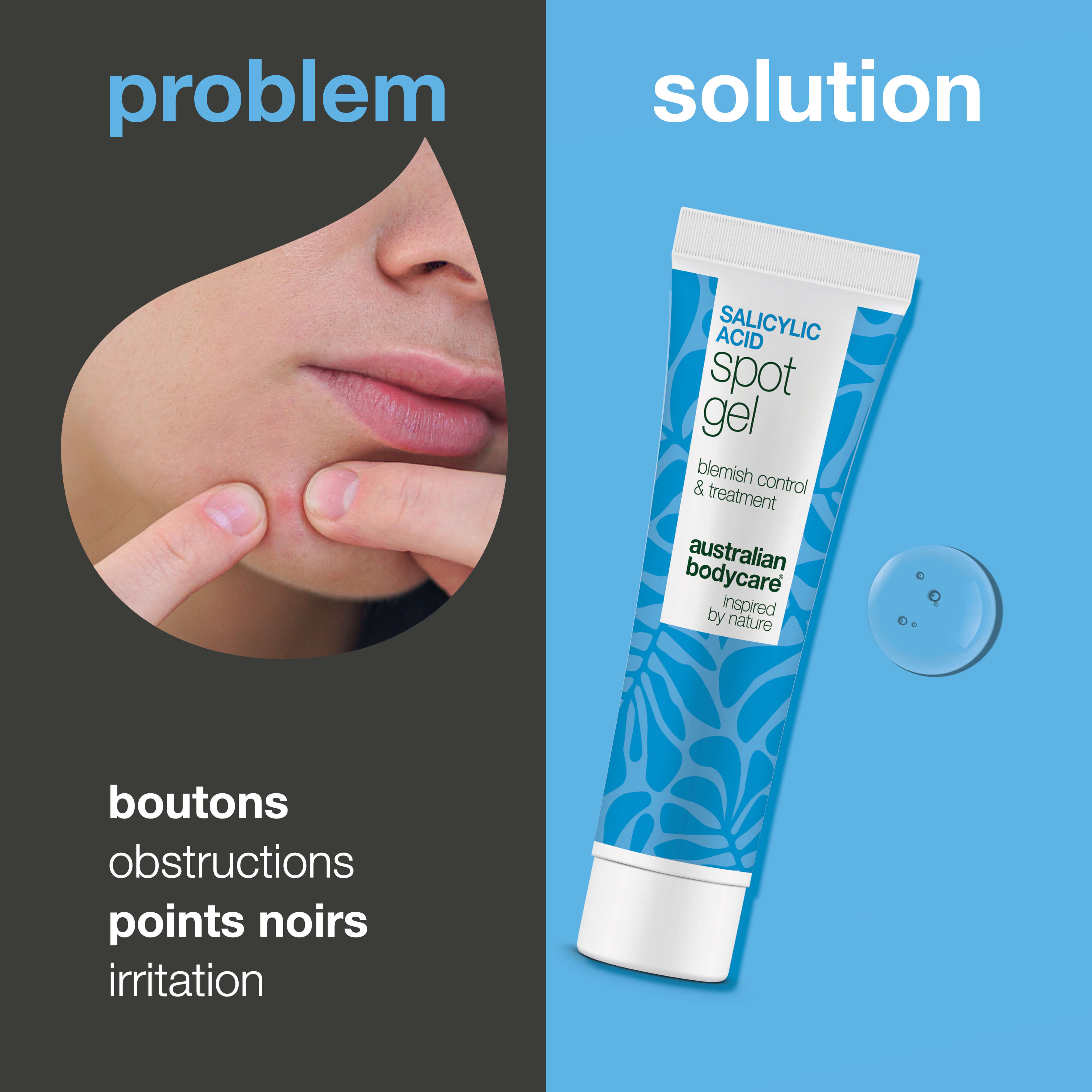 Gel Ciblée à l’Acide Salicylique pour boutons et pores — Gel Ciblée à l’Acide Salicylique nettoie les pores, élimine le sébum et affine la peau grâce à l’acide salicylique.