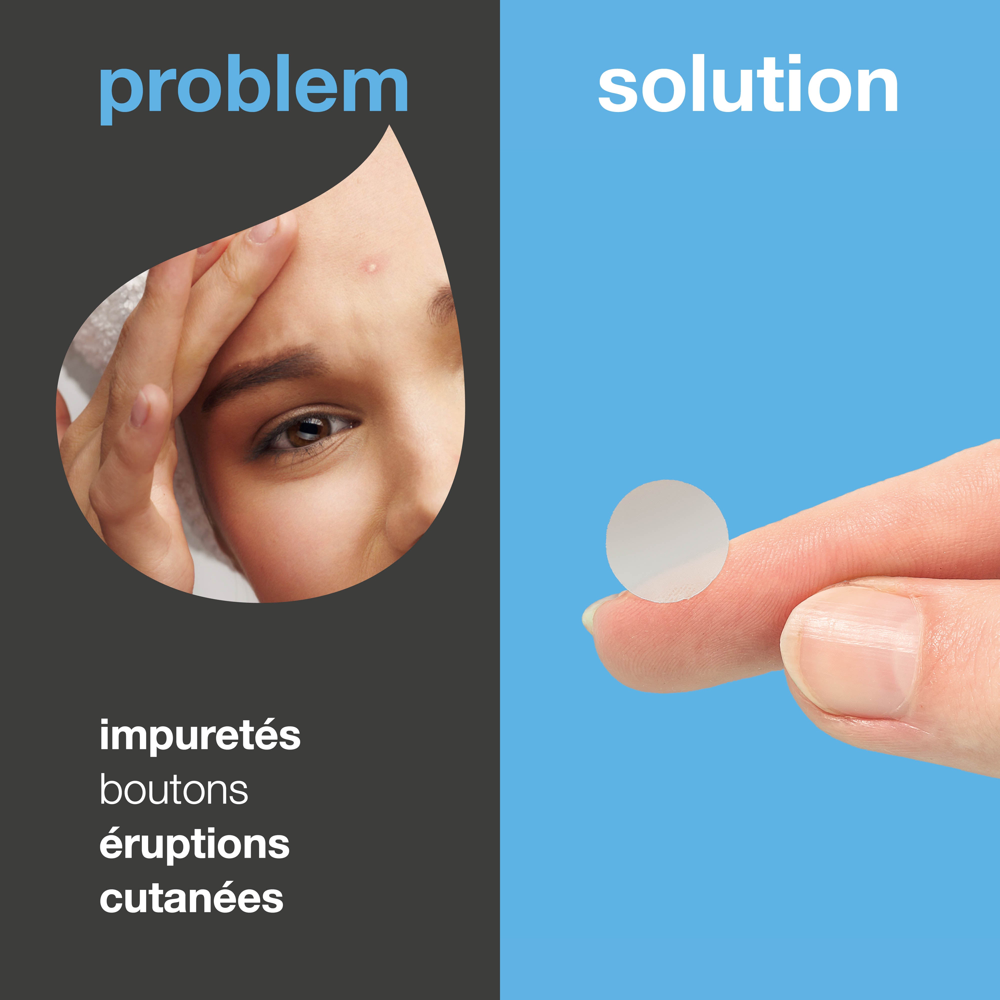 Patchs boutons à l'acide salicylique contre les imperfections et la peau irritée. Contient acide salicylique, Camellia Sinensis et acide hyaluronique.