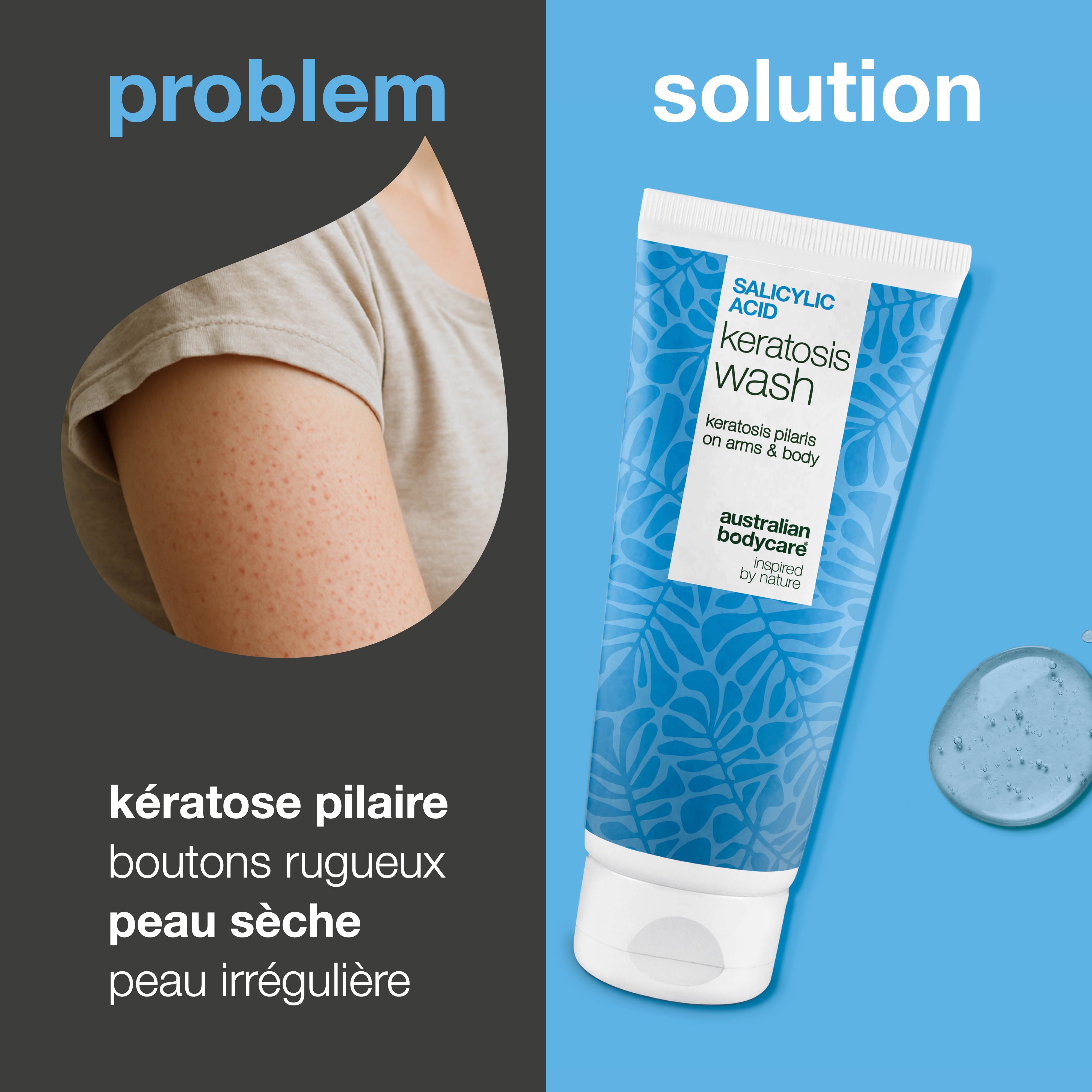 Keratosis Pilaris Body Wash contre la kératose pilaire, rougeurs et pores obstrués. Formulé avec acide salicylique, niacinamide, zinc PCA et vitamine E.