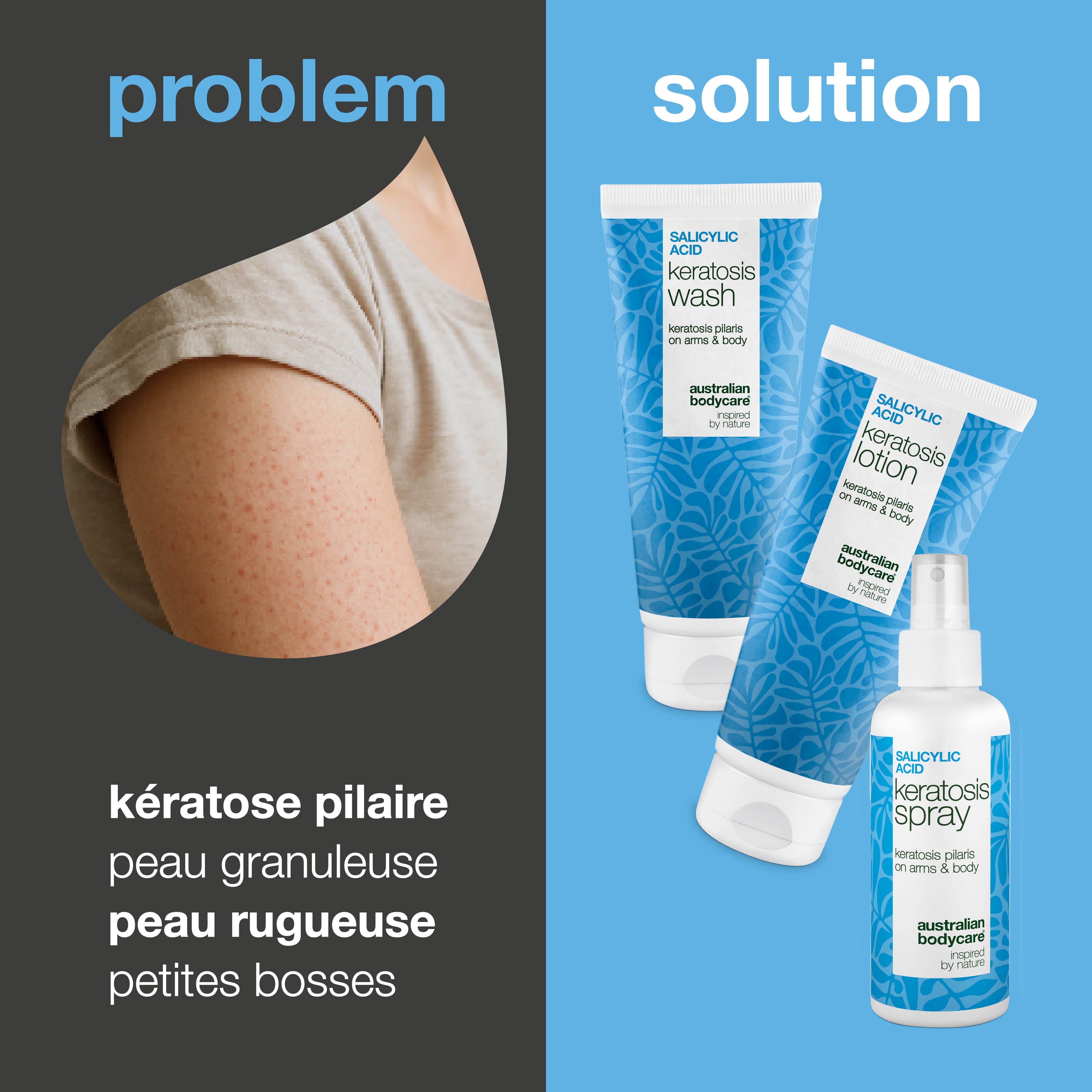 Coffret Kératose Pilaire – Lisse la peau sèche, granuleuse et peau de fraise — Soin corps contre la Kératose Pilaire réduit la peau bosselée et granuleuse. Pour une peau douce, lisse et uniforme.