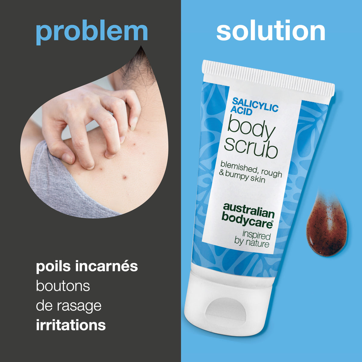 Problème et solution : boutons sur le corps, pores obstrués et peau irrégulière. À gauche, gros plan d’une épaule avec des boutons, à droite le Salicylic Acid Body Scrub d’Australian Bodycare