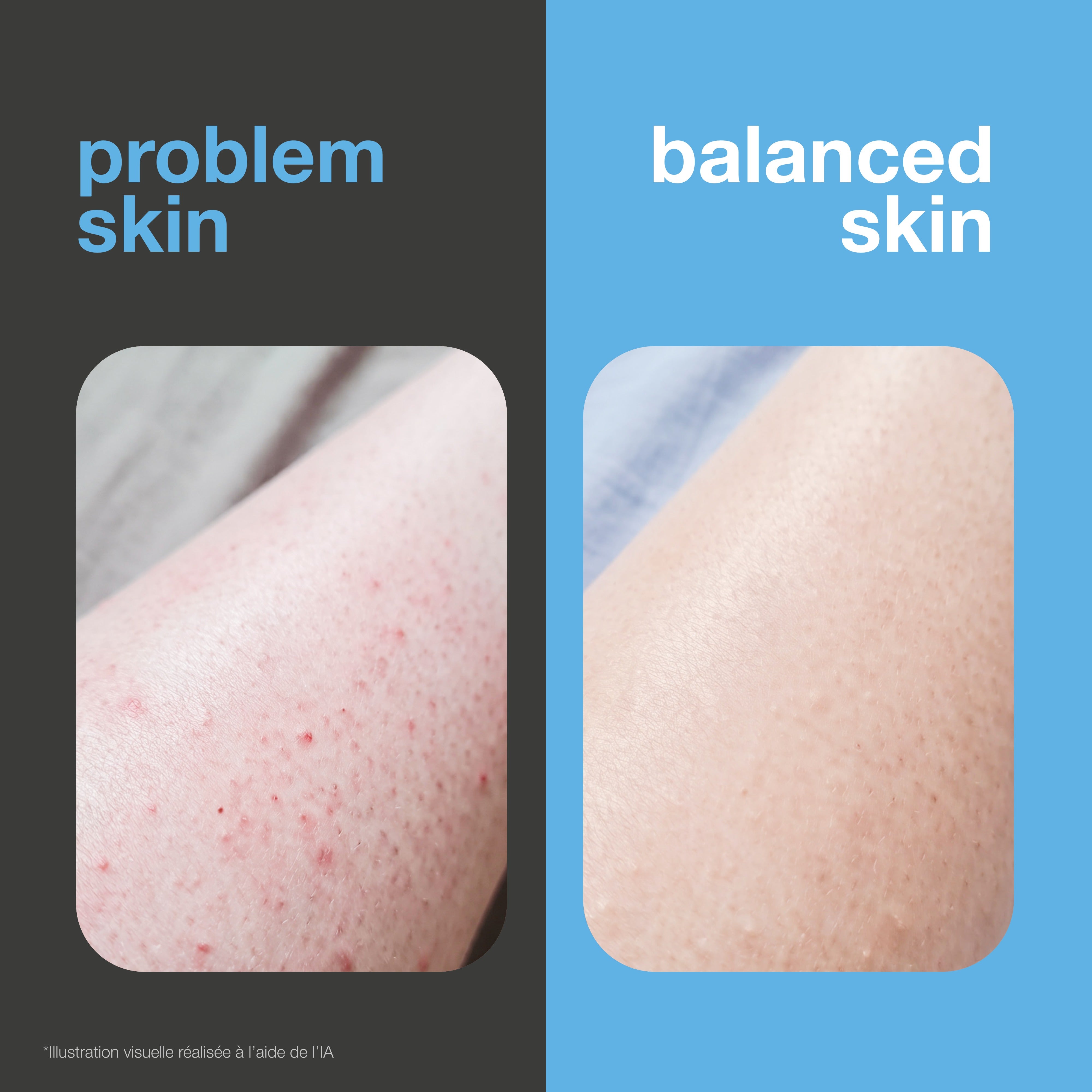 Avant et après : peau rasée avec boutons de rasage et irritations face à une peau lisse et apaisée. Illustration visuelle.