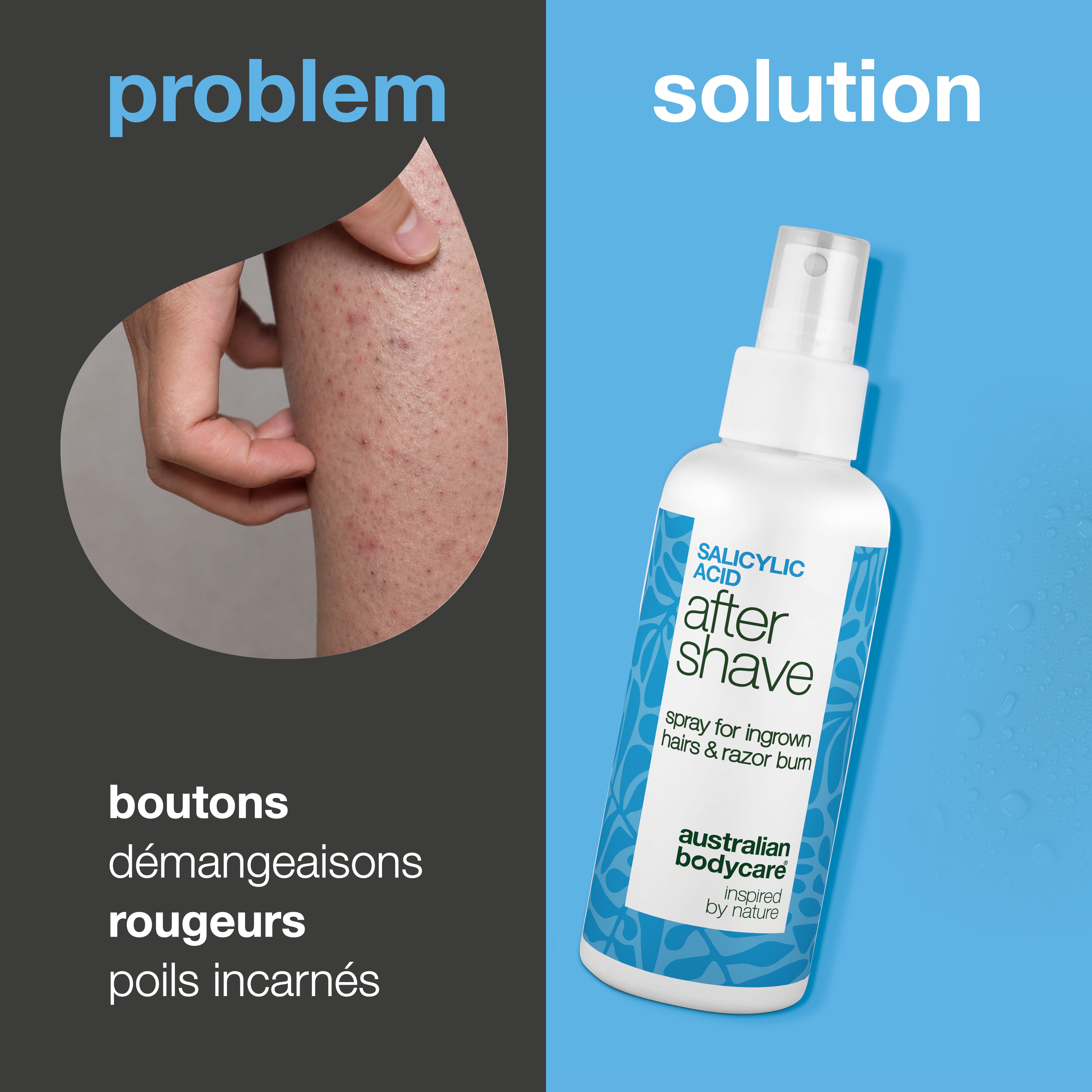 Spray Après-Rasage Acide Salicylique anti-boutons — Spray après-rasage contre les boutons de rasage et poils incarnés. À l'acide salicylique et aloe vera pour apaiser les démangeaisons.