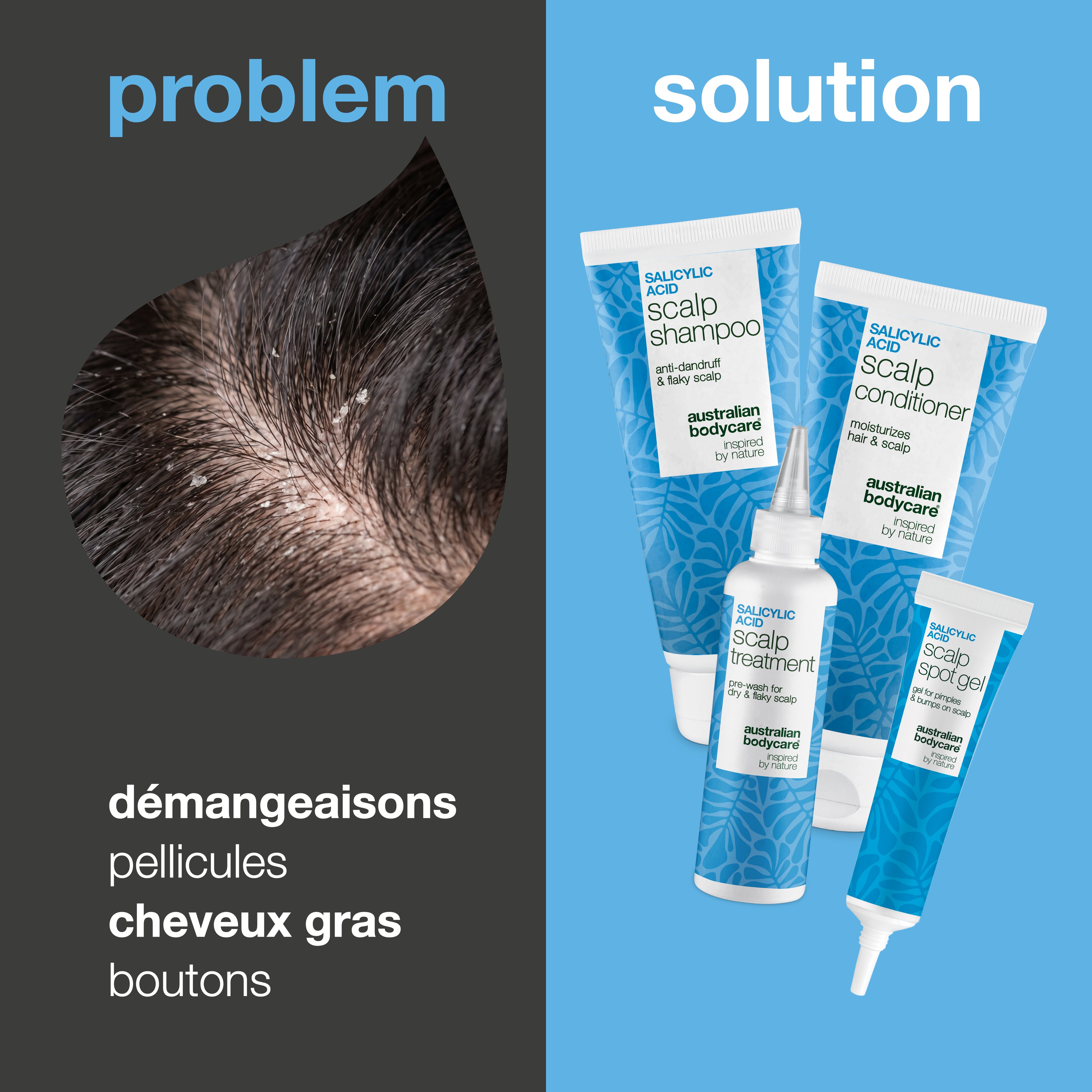Problème et solution : gros plan sur les pellicules du cuir chevelu et les quatre produits du kit contre démangeaisons, pellicules et boutons