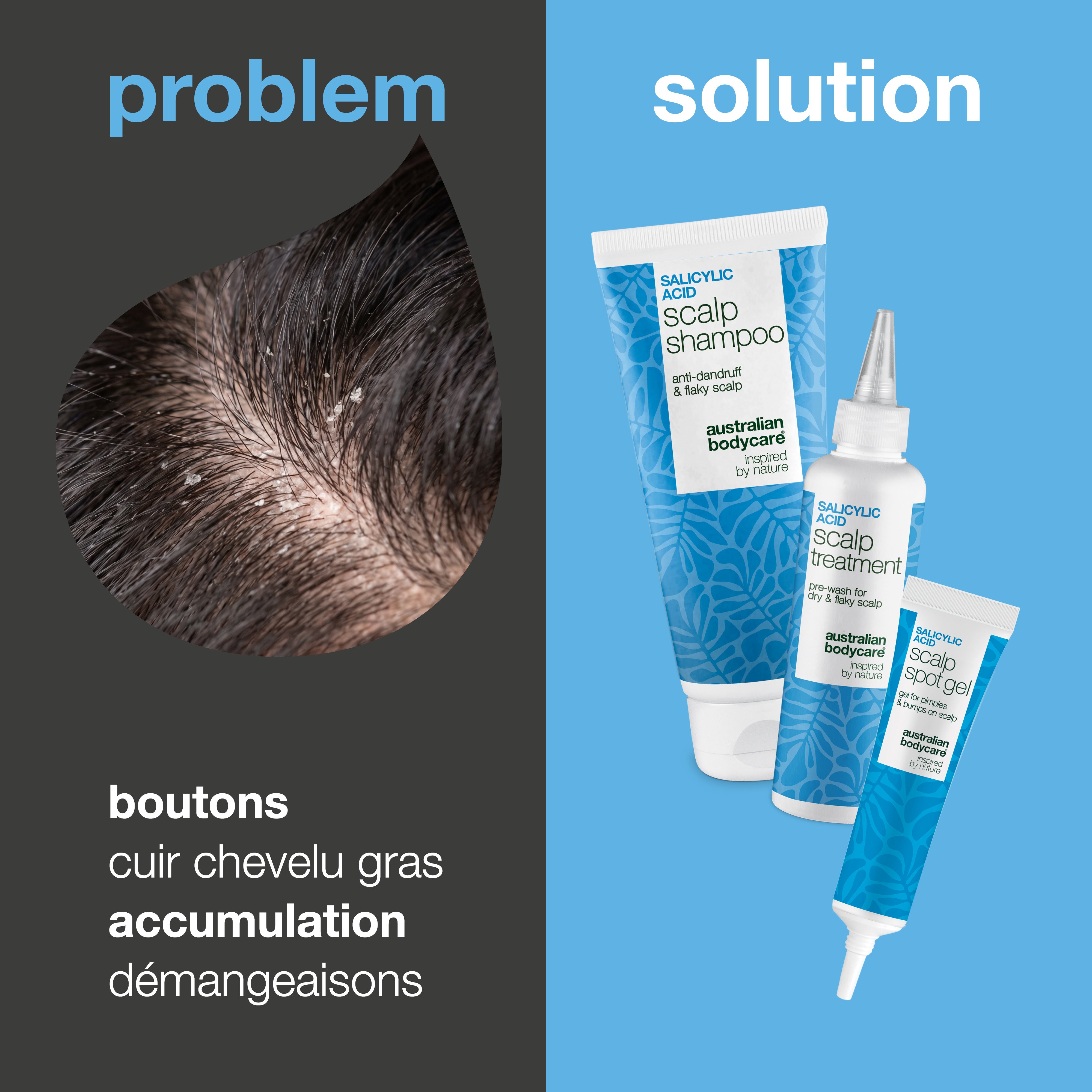 Problème et solution : gros plan sur démangeaisons, cheveux gras et accumulation de résidus à côté des trois produits du kit