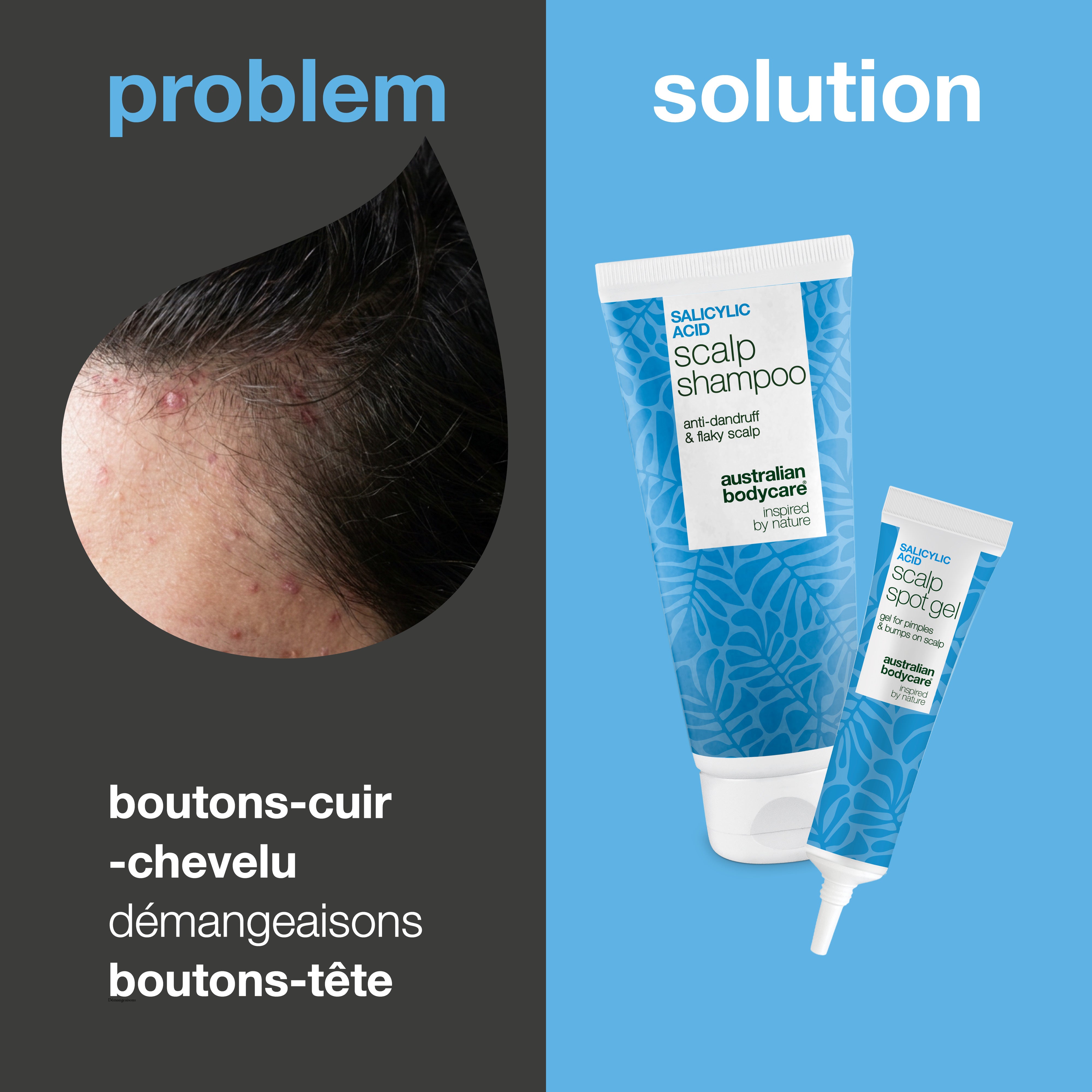 Problème et solution : gros plan sur boutons et bosses du cuir chevelu à côté du shampoing et du gel du kit