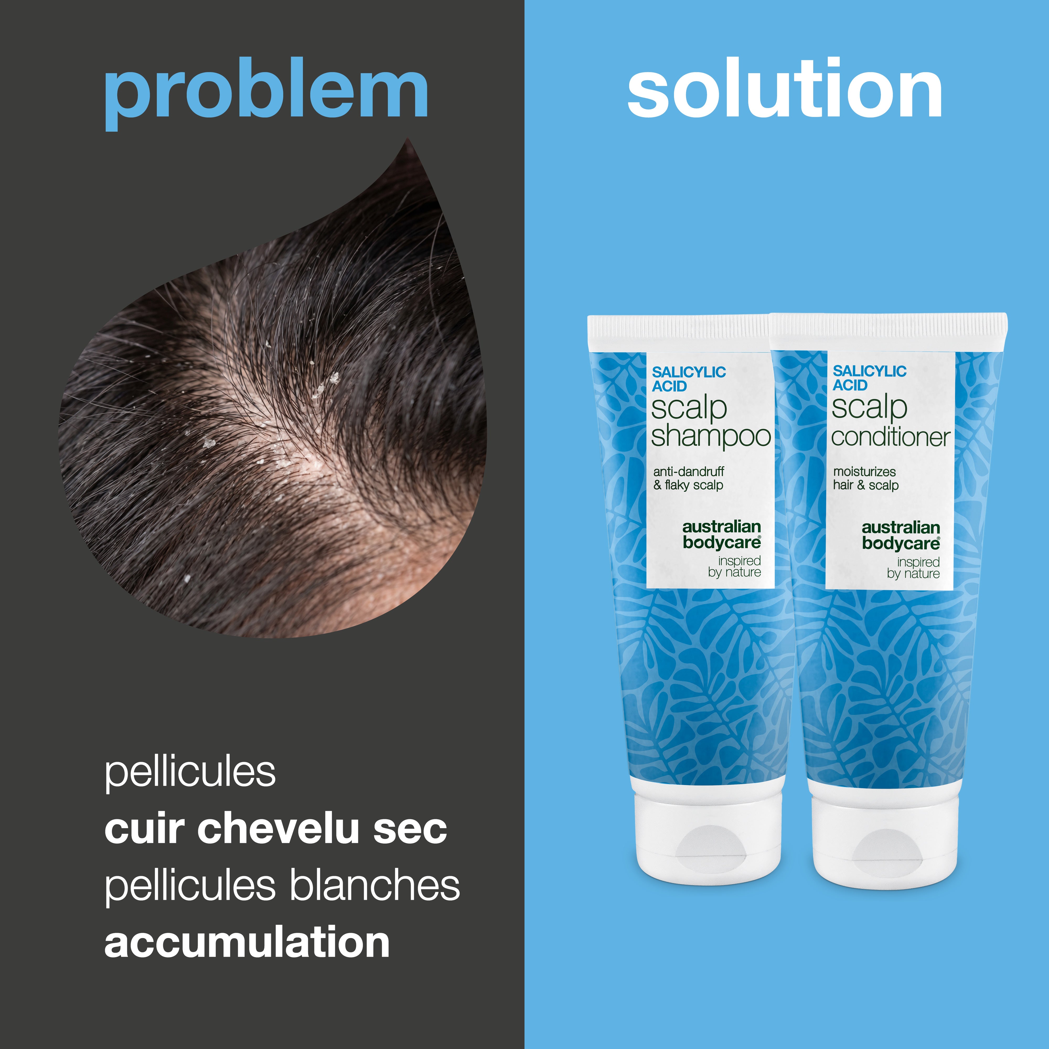 Problème et solution : gros plan sur les pellicules et squames du cuir chevelu à côté du shampoing et de l'après-shampoing du kit
