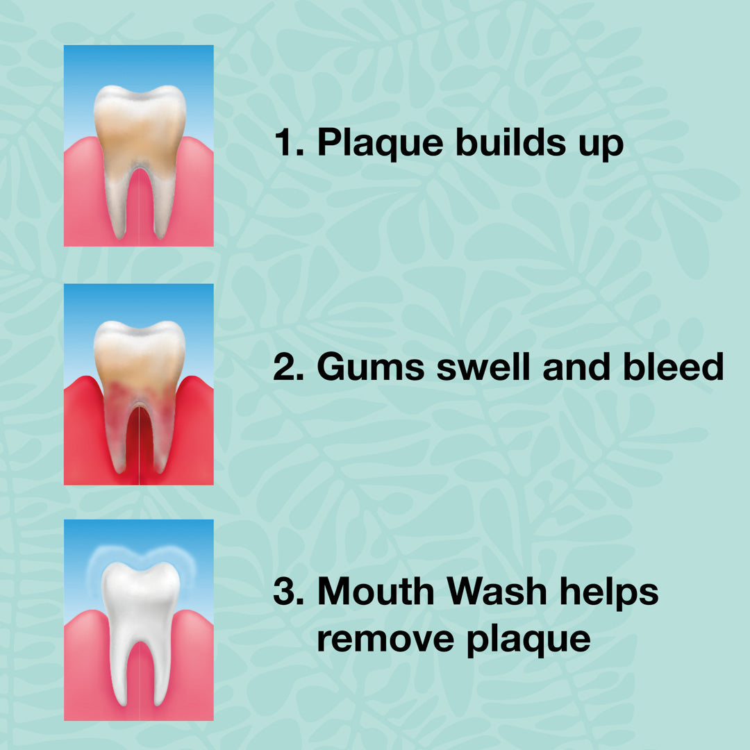 3 Dentifrice à l'huile de tea tree et menthe fraiche — Pour le traitement quotidien des maladies parodontales, des mycoses et de la gingivite