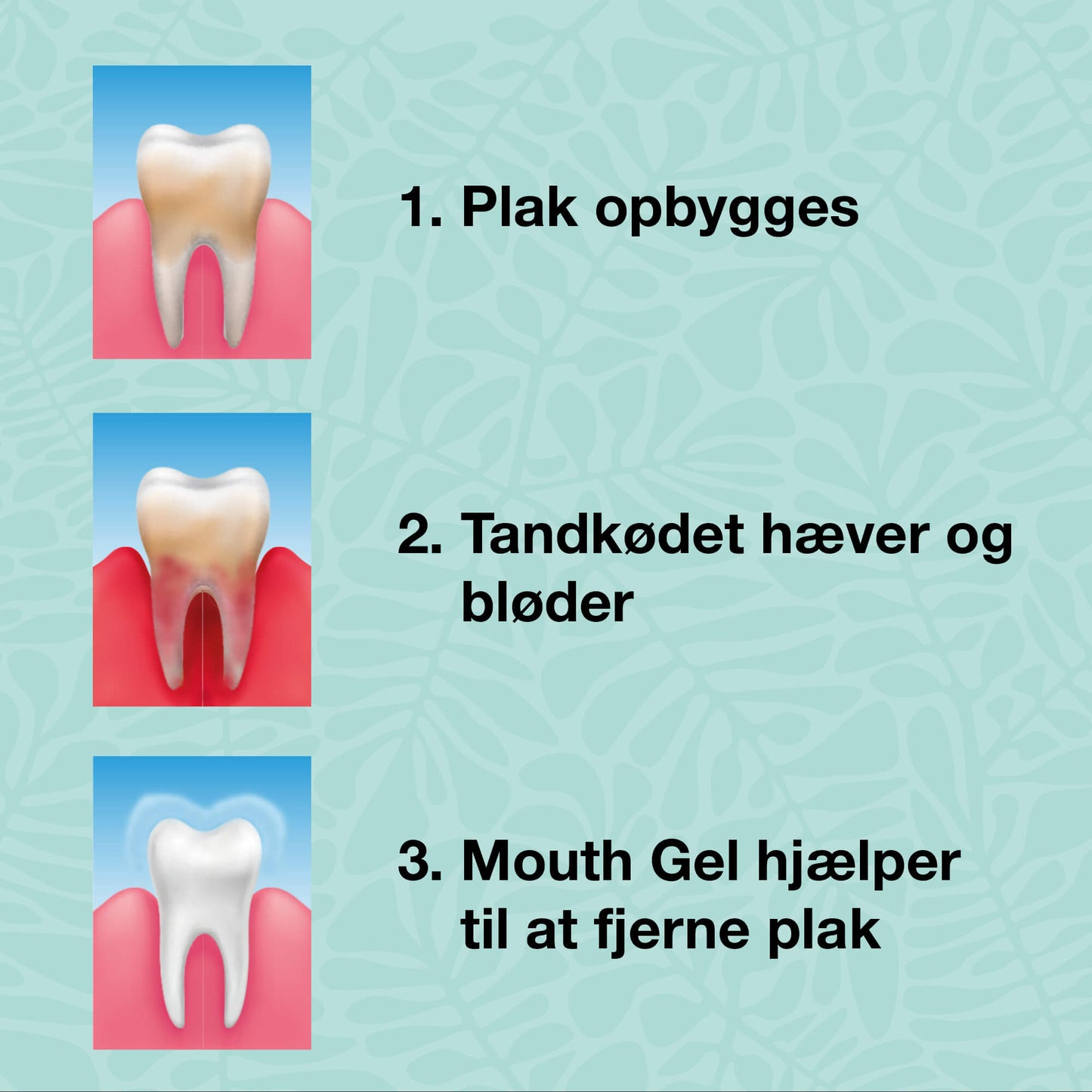 Kit de démarrage – 5 produits bucco-dentaires - Kit de démarrage pour une bonne hygiène buccale et le traitement des maladies parodontales et des mycoses