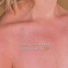 Femme appliquant un spray corporel à l’acide salicylique – avant/après avec moins d’acné et une peau plus nette.