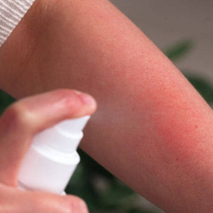 Spray pour lutter contre la peau irritée qui démange - Spray apaisant et calmant pour la peau irritée et les démangeaisons.