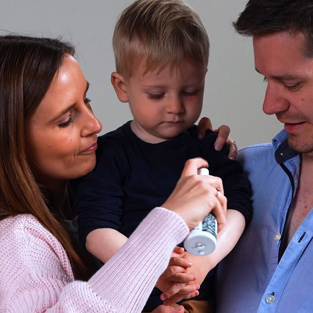 Spray pour lutter contre la peau irritée qui démange — Spray apaisant et calmant pour la peau irritée et les démangeaisons.