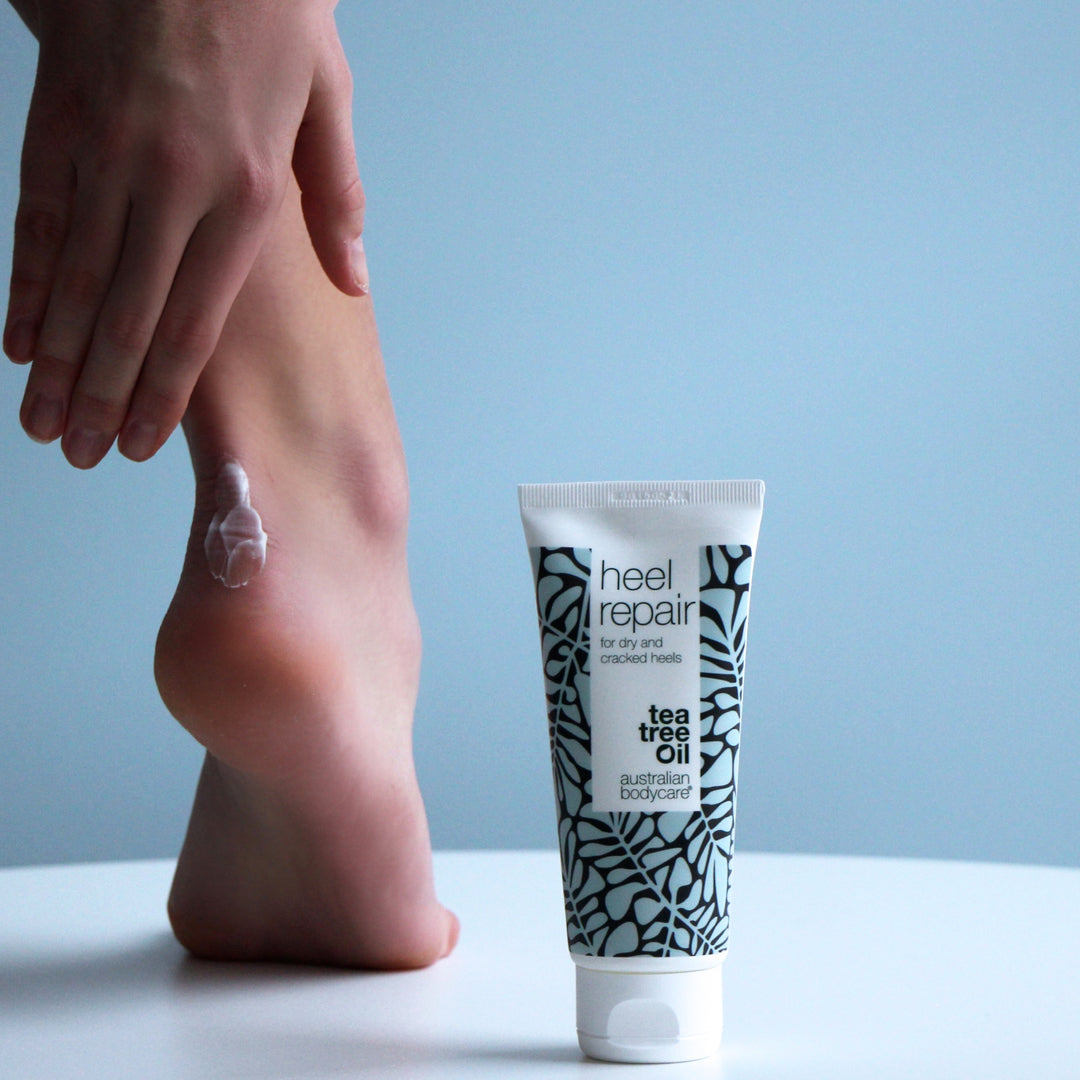 Crème pour talons fissurés et gercés avec 25% d'urée et huile de tea tree —  Crème pour talons pour les talons fissurés et gercés et la peau dure sur le talon.